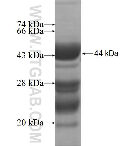 CYTSB fusion protein Ag4931 SDS-PAGE