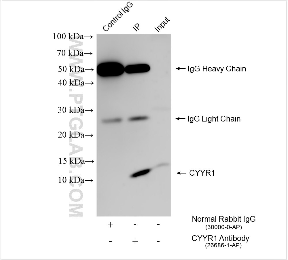 Immunoprecipitation (IP) experiment of mouse pancreas tissue using CYYR1 Polyclonal antibody (26686-1-AP)