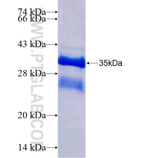 CYYR1 fusion protein Ag24710 SDS-PAGE