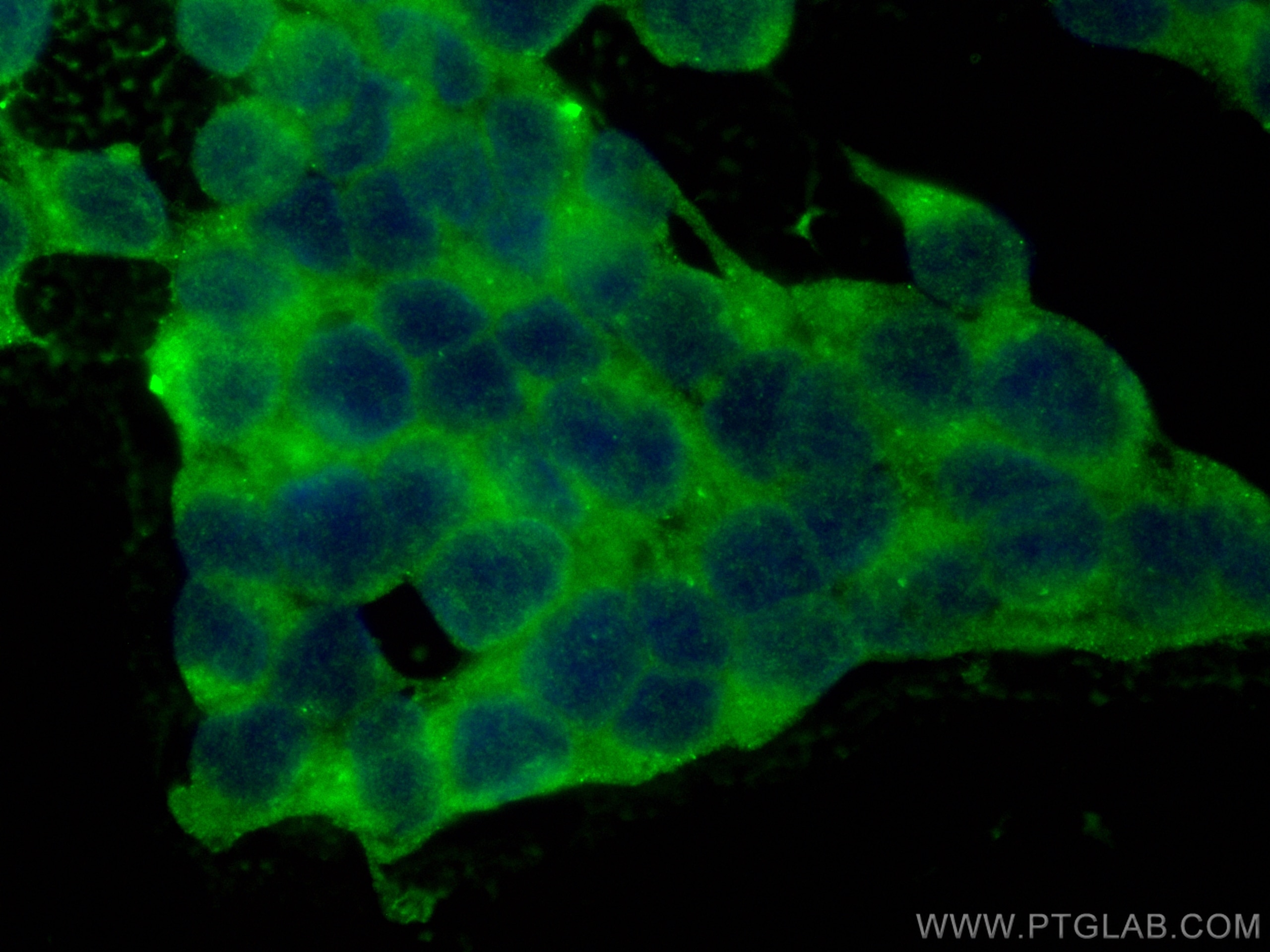 Immunofluorescence (IF) / fluorescent staining of SH-SY5Y cells using CoraLite® Plus 488-conjugated CaMKII alpha Polyclo (CL488-13730)