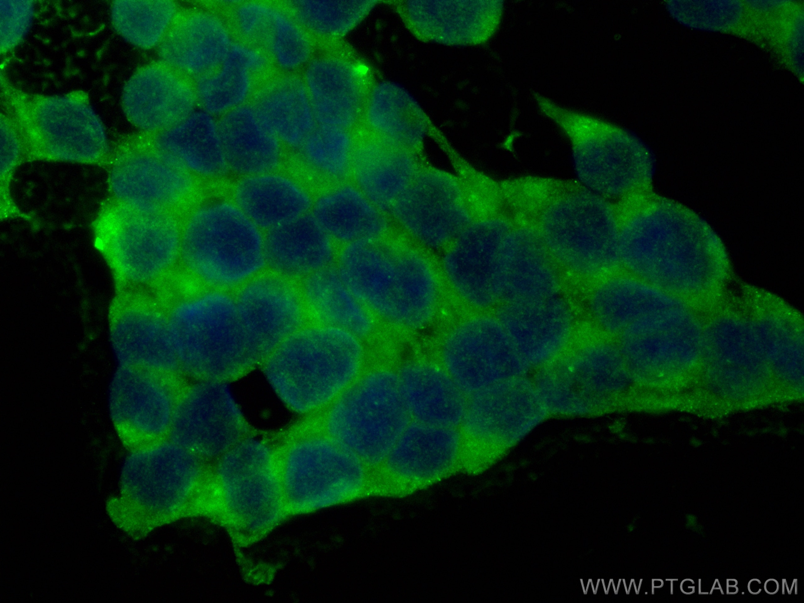 IF Staining of SH-SY5Y using CL488-13730