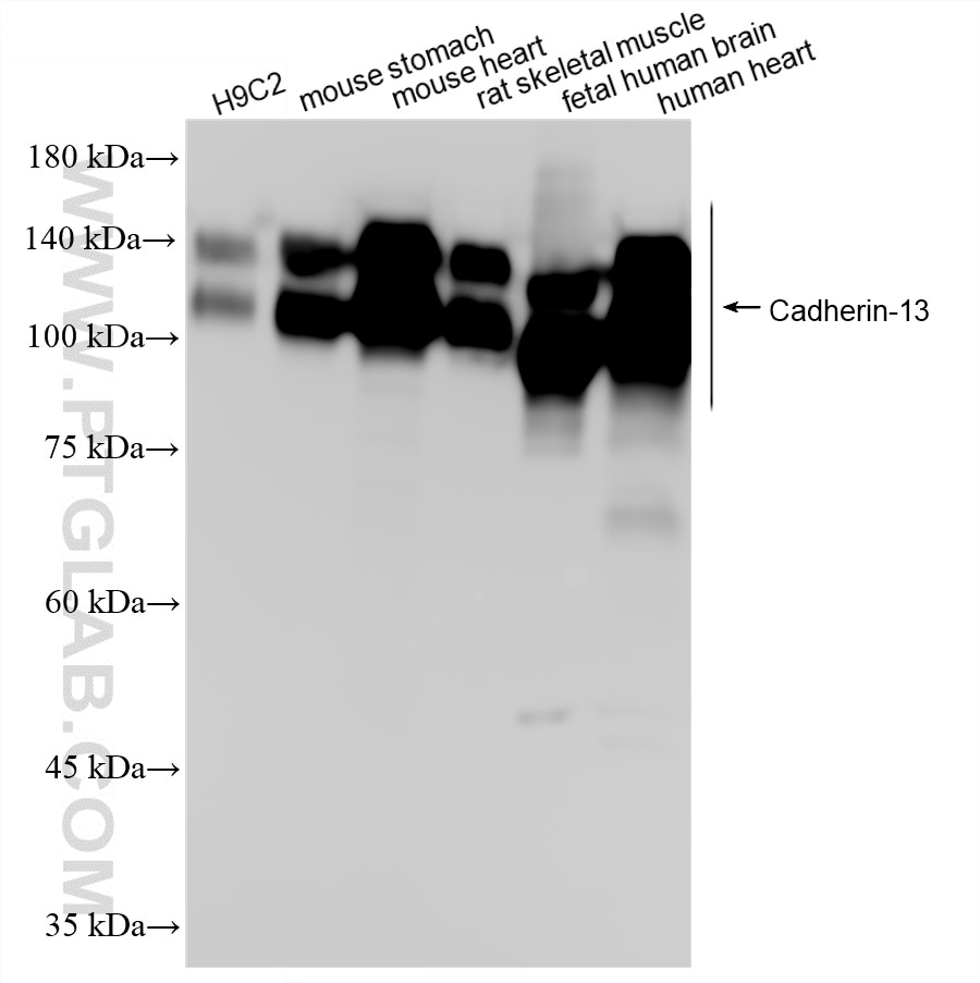 WB analysis using 87073-1-RR Western Blot (WB) analysis of various lysates using Cadherin-13 Recombinant monoclonal antibody (87073-1-RR)