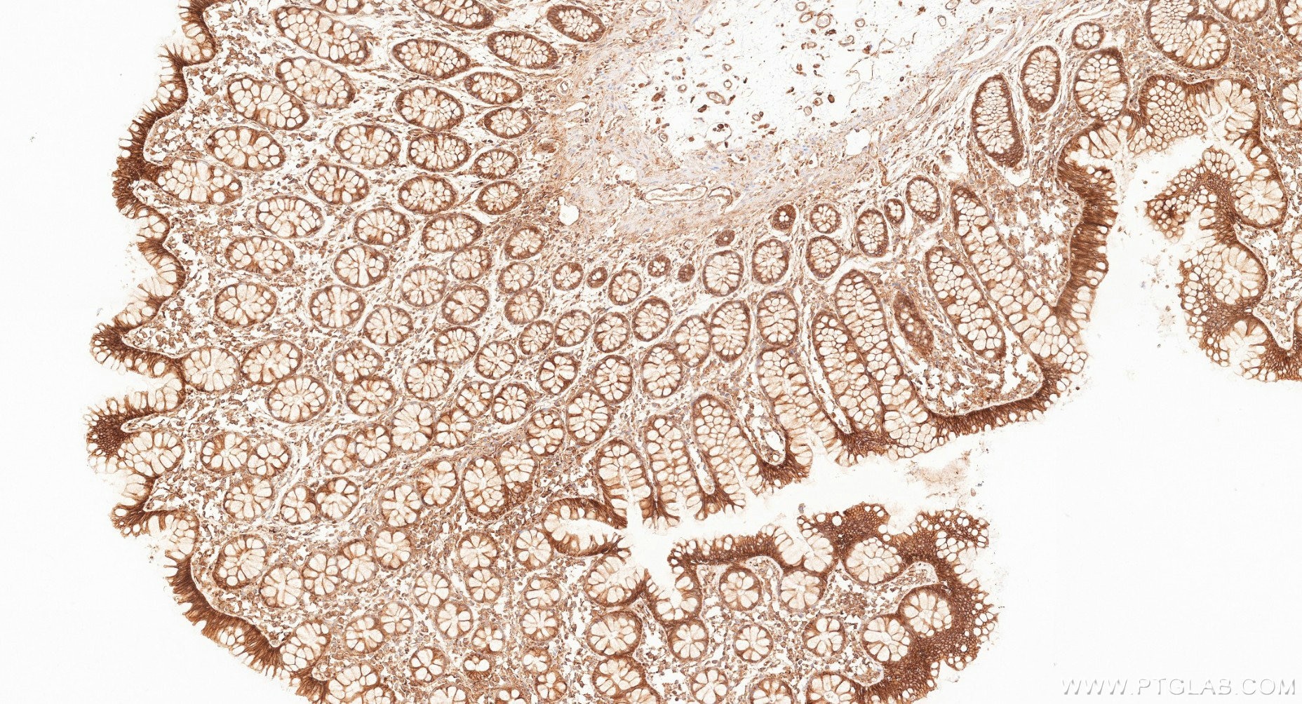 IHC staining of human large intestine using 87073-2-RR (same clone as 87073-2-PBS) Immunohistochemistry (IHC) staining of human large intestine tissue using Cadherin-13 Recombinant monoclonal antibody (87073-2-RR)