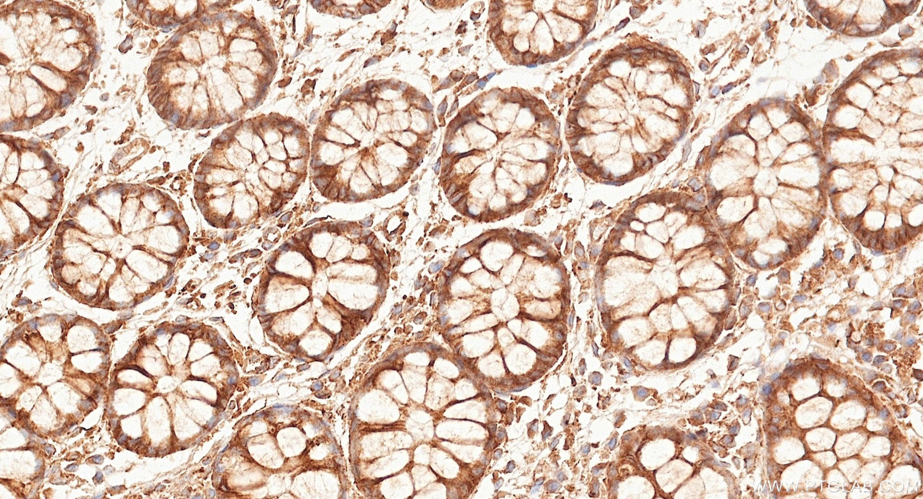 IHC staining of human large intestine using 87073-2-RR (same clone as 87073-2-PBS) Immunohistochemistry (IHC) staining of human large intestine tissue using Cadherin-13 Recombinant monoclonal antibody (87073-2-RR)