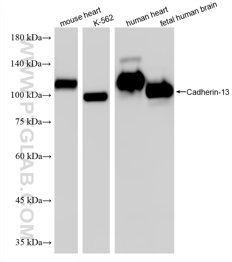 Western Blot (WB) analysis of various lysates using Cadherin-13 Recombinant monoclonal antibody (87073-2-RR)