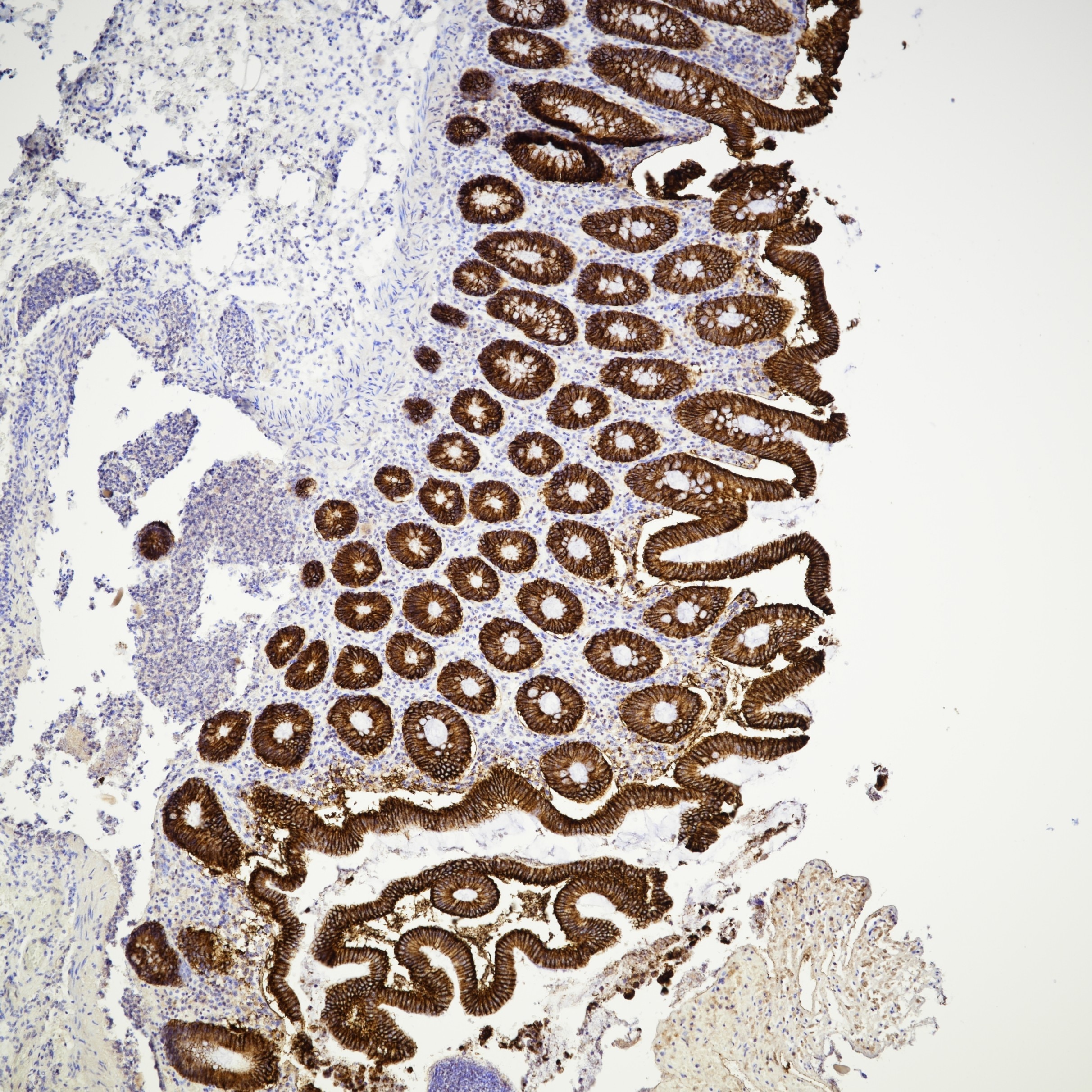 Immunohistochemistry (IHC) staining of human colon tissue using Cadherin-17 Recombinant monoclonal antibody (83793-5-RR)