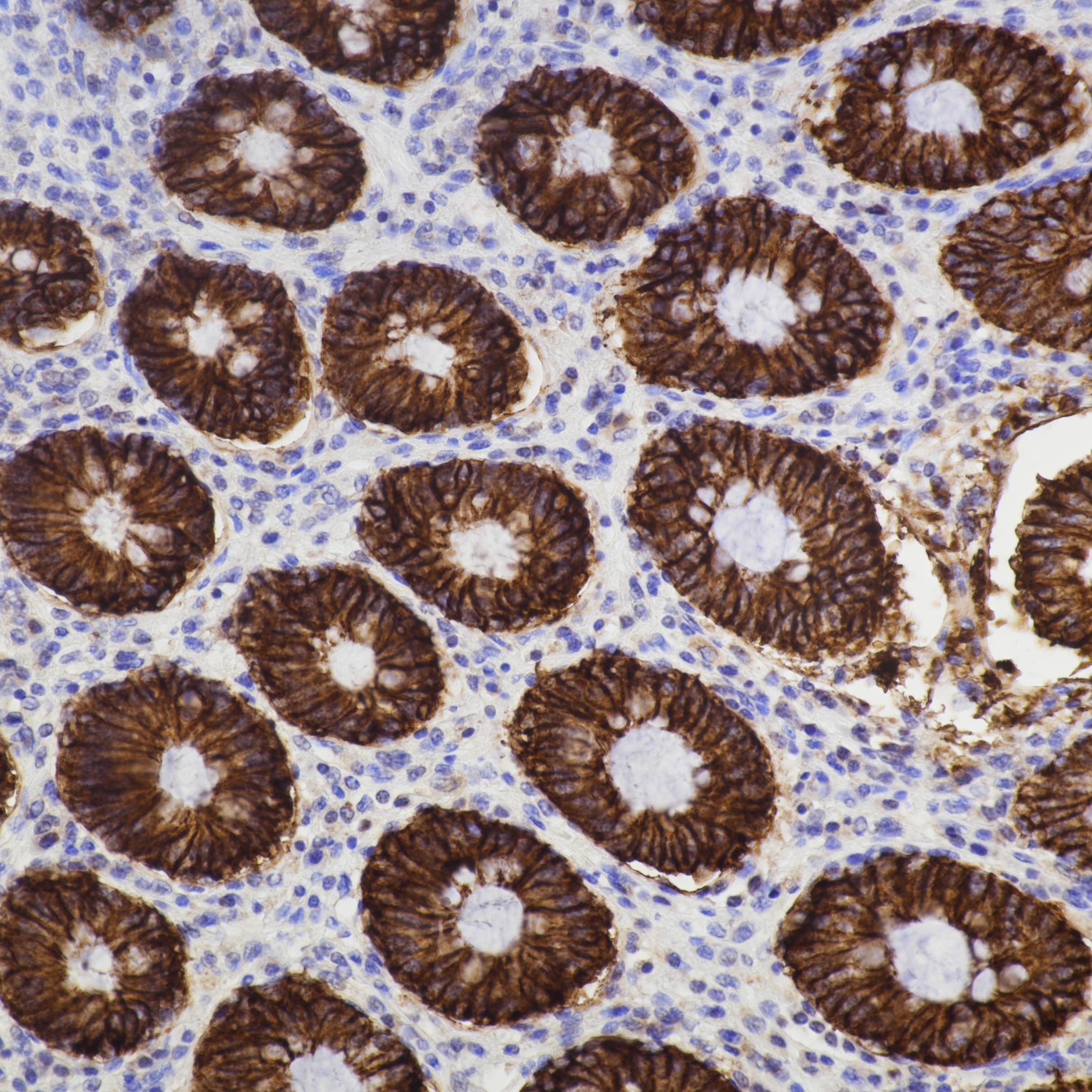 Immunohistochemistry (IHC) staining of human colon tissue using Cadherin-17 Recombinant monoclonal antibody (83793-5-RR)