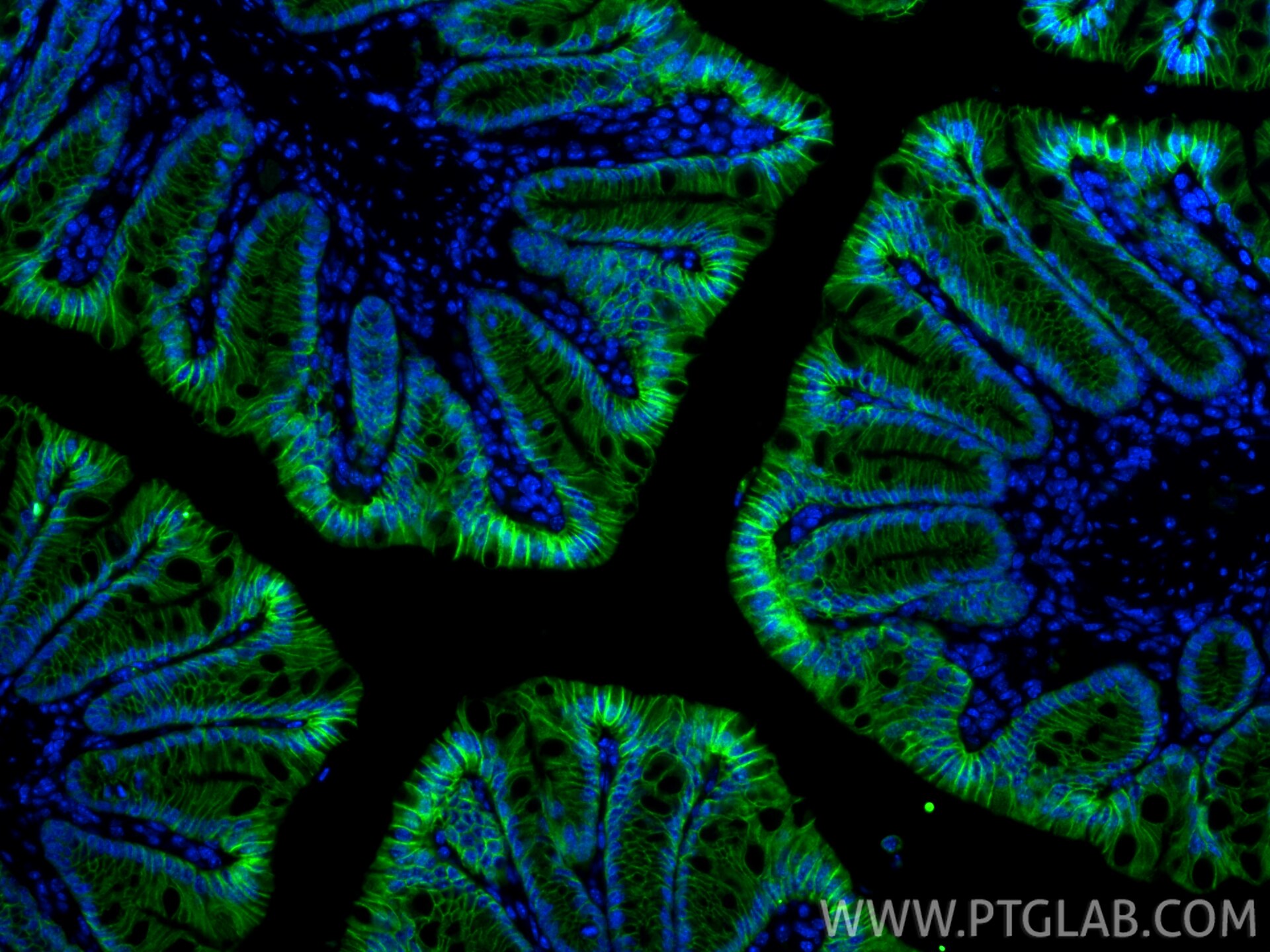 Immunofluorescence (IF) / fluorescent staining of mouse colon tissue using CoraLite® Plus 488-conjugated Cadherin-17 Recombin (CL488-83793-5)