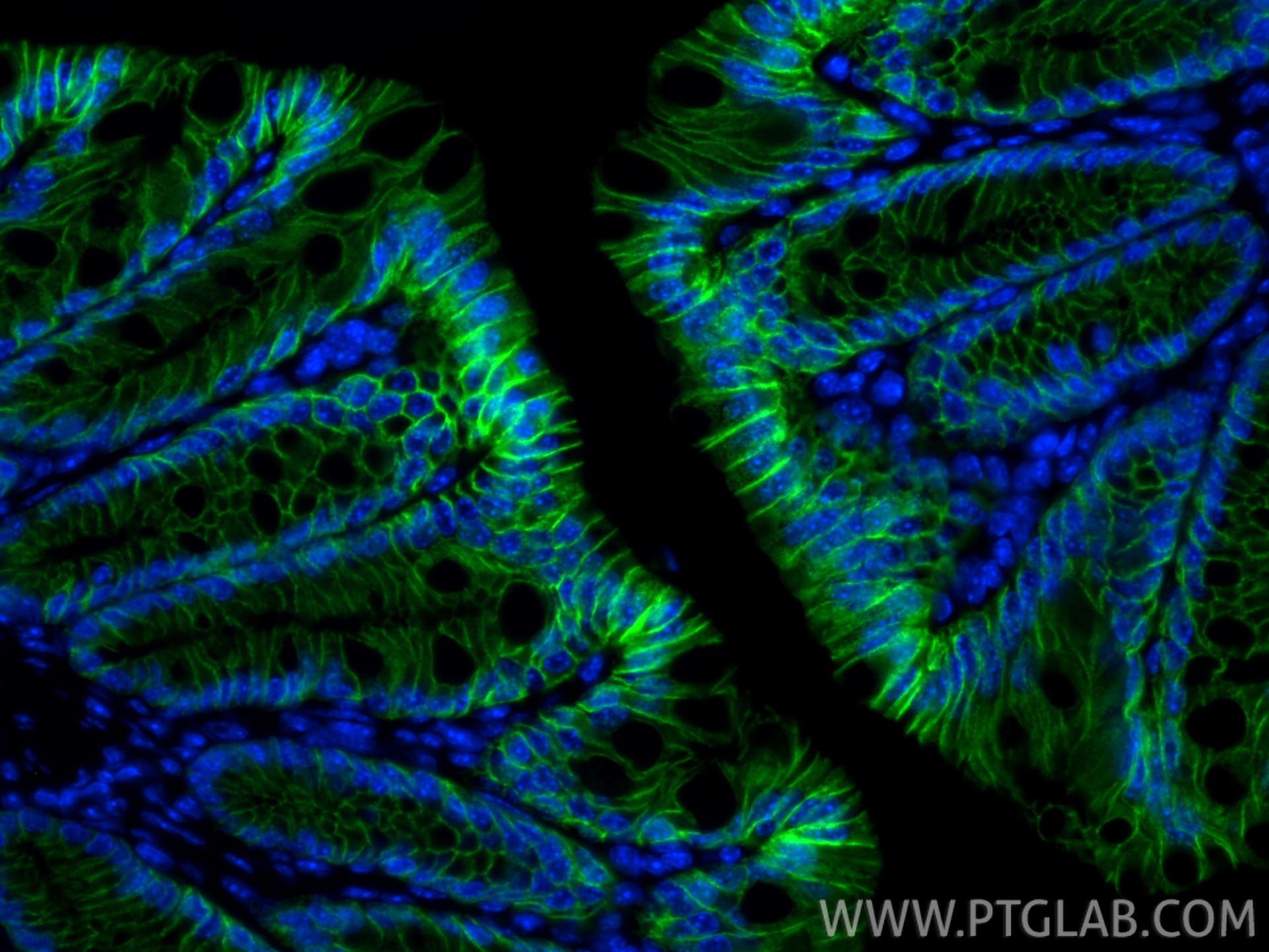 Immunofluorescence (IF) / fluorescent staining of mouse colon tissue using CoraLite® Plus 488-conjugated Cadherin-17 Recombin (CL488-83793-5)
