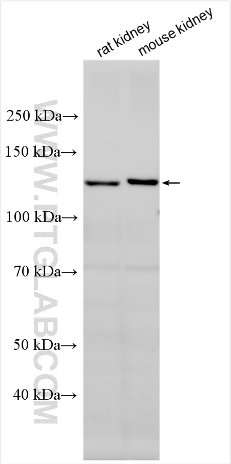 Western Blot (WB) analysis of various lysates using Cadherin-6 Polyclonal antibody (27703-1-AP)