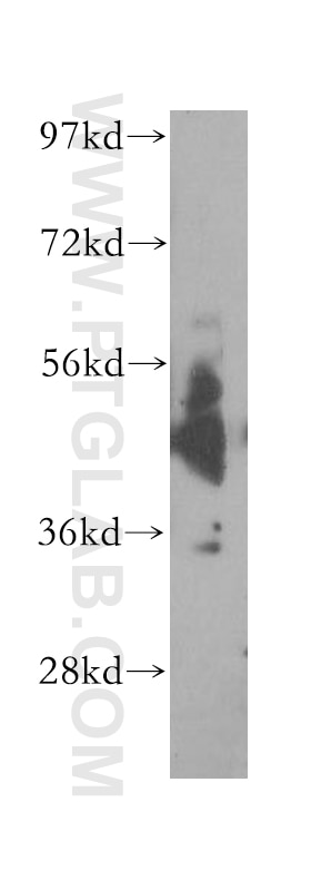 Western Blot (WB) analysis of mouse testis tissue using Cadm1 Polyclonal antibody (51059-1-AP)