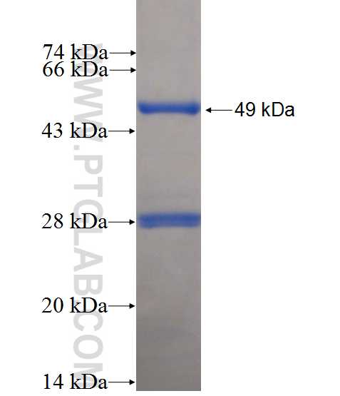 Cadm1 fusion protein Ag0449 SDS-PAGE
