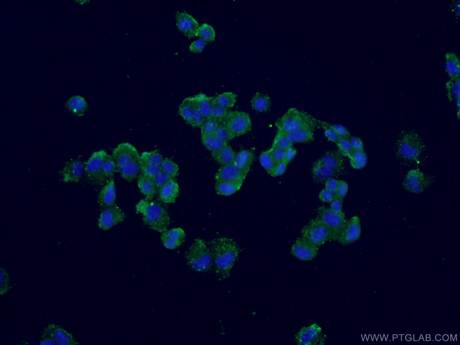 Immunofluorescence (IF) / fluorescent staining of PC-12 cells using Calbindin-D28k Monoclonal antibody (66394-1-Ig)