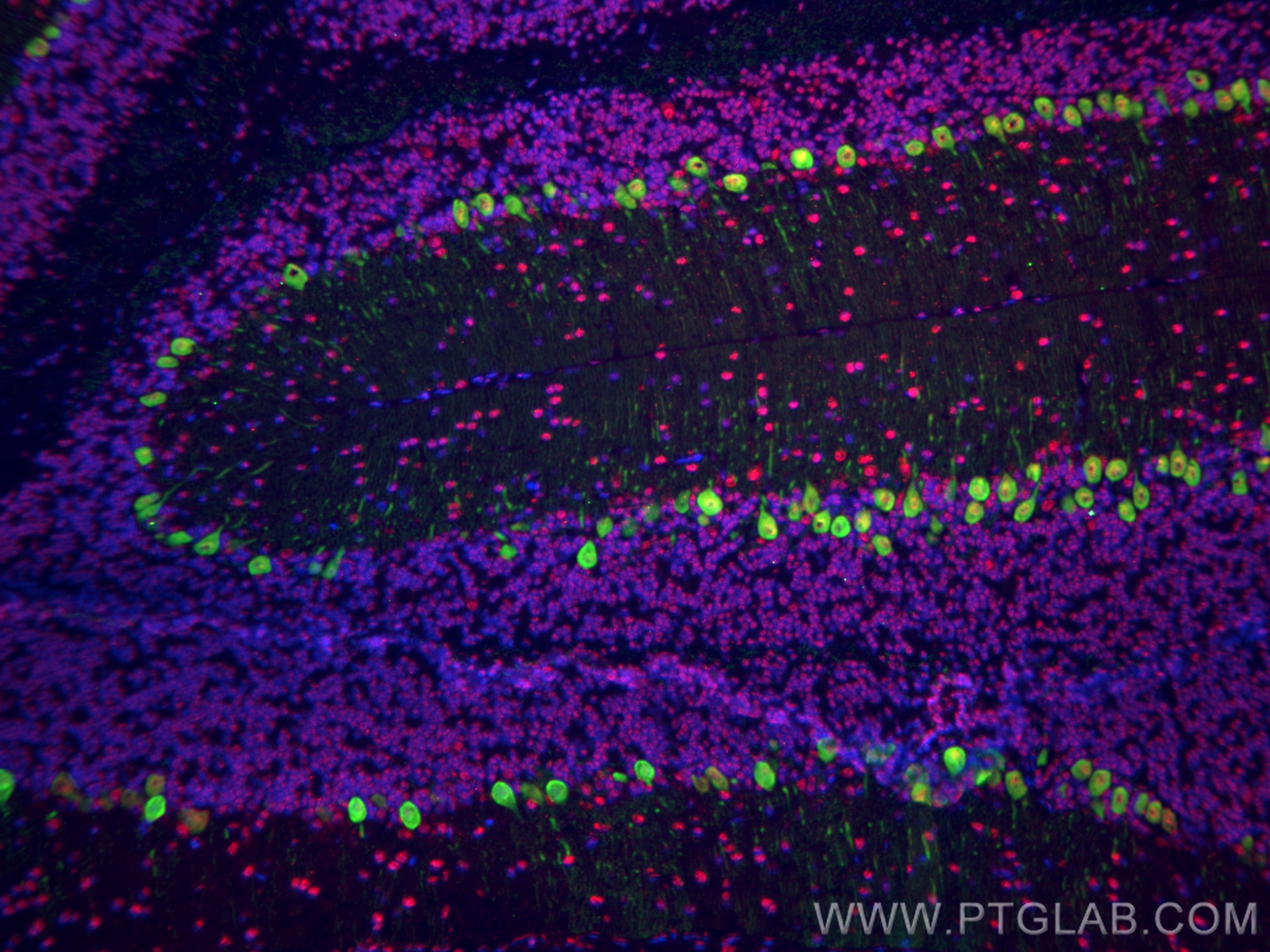 Immunofluorescence (IF) / fluorescent staining of mouse cerebellum tissue using Calbindin-D28k Monoclonal antibody (66394-1-Ig)