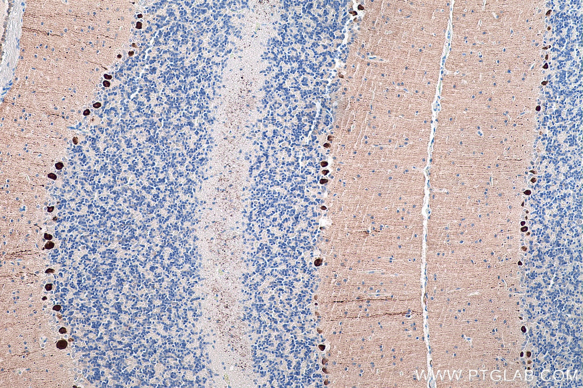 Immunohistochemistry (IHC) staining of rat cerebellum tissue using Calbindin-D28k Monoclonal antibody (66394-1-Ig)