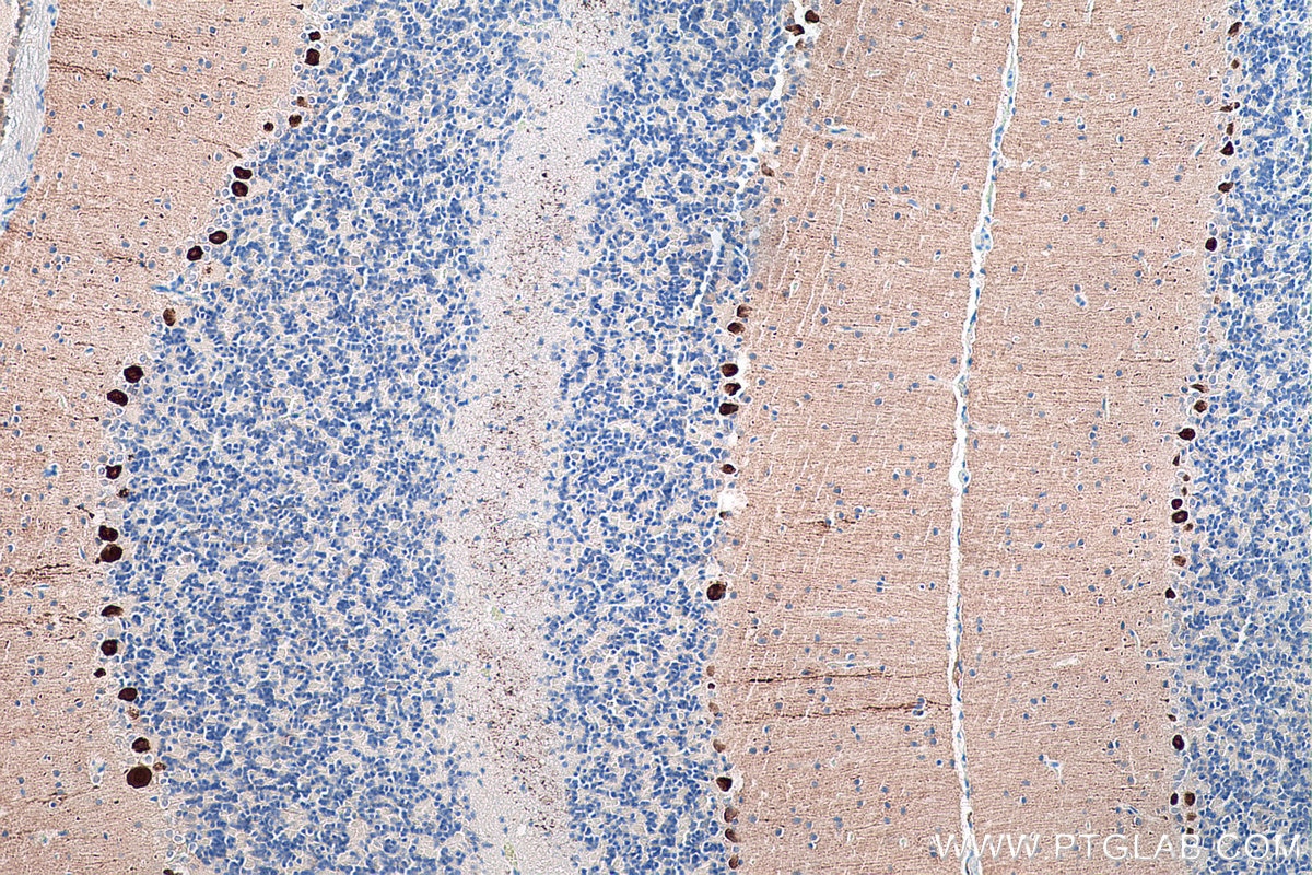 IHC staining of rat cerebellum using 66394-1-Ig