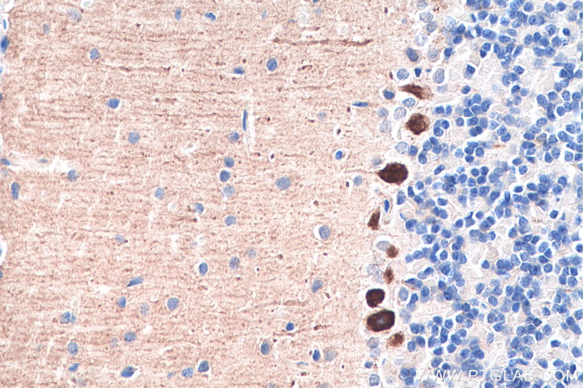 Immunohistochemistry (IHC) staining of rat cerebellum tissue using Calbindin-D28k Monoclonal antibody (66394-1-Ig)