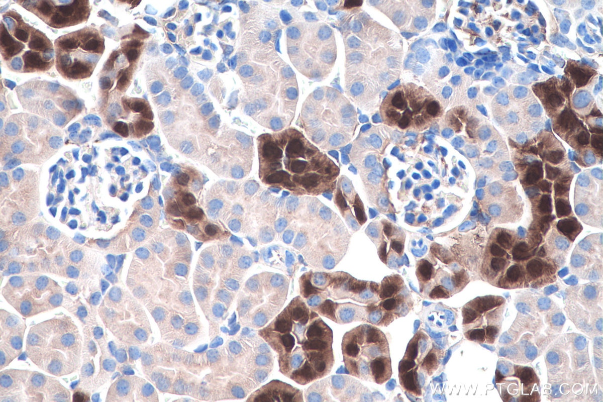 Immunohistochemistry (IHC) staining of mouse kidney tissue using Calbindin-D28k Monoclonal antibody (66394-1-Ig)