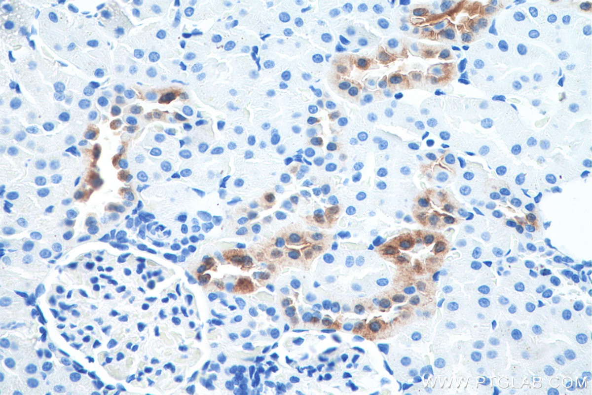 Immunohistochemistry (IHC) staining of rat kidney tissue using Calbindin-D28k Monoclonal antibody (66394-1-Ig)