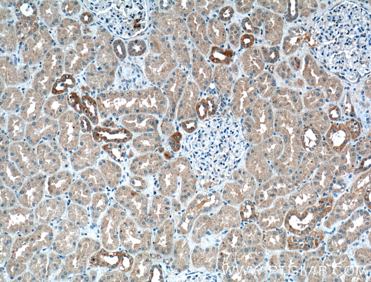 Immunohistochemistry (IHC) staining of human kidney tissue using Calbindin-D28k Monoclonal antibody (66394-1-Ig)