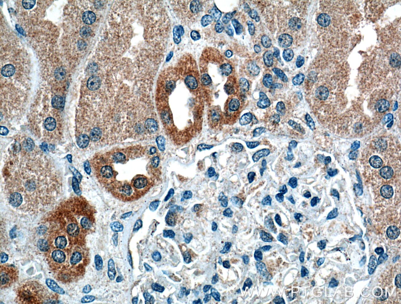 Immunohistochemistry (IHC) staining of human kidney tissue using Calbindin-D28k Monoclonal antibody (66394-1-Ig)