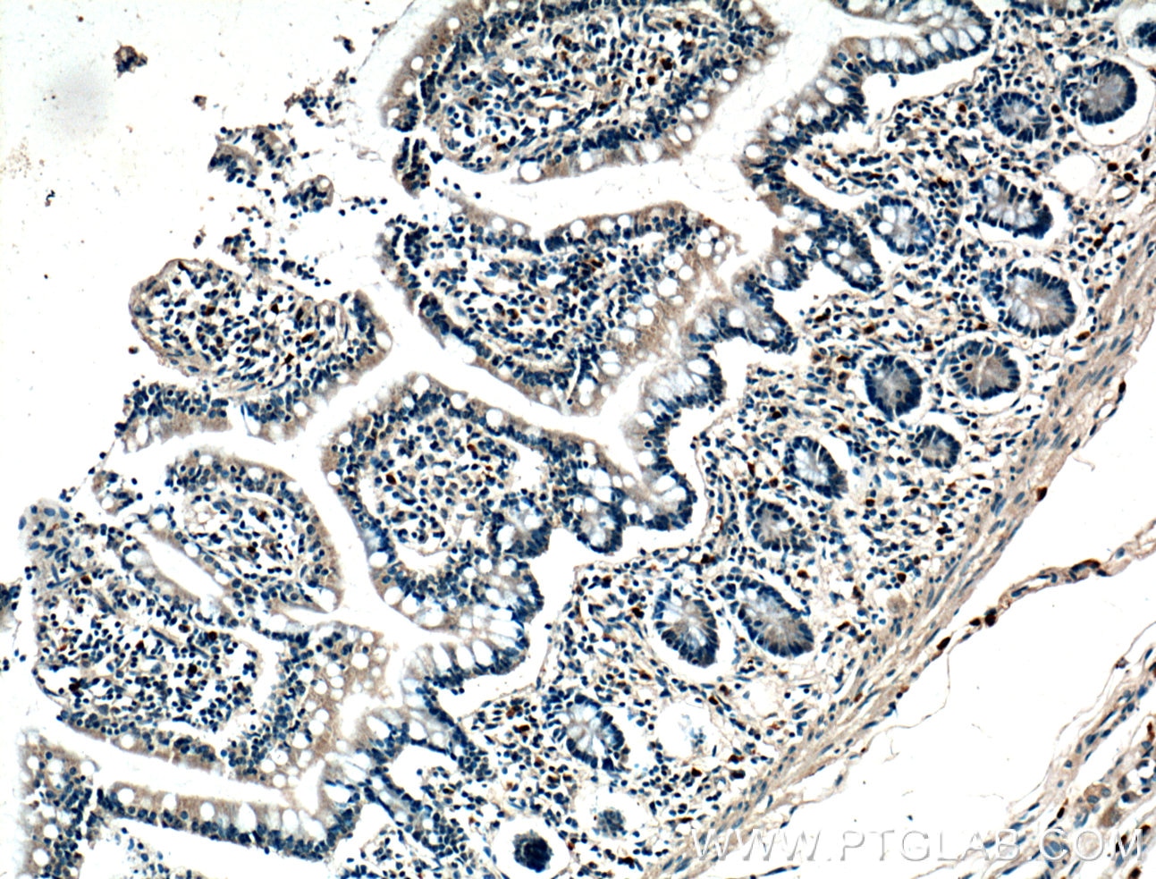 Immunohistochemistry (IHC) staining of human small intestine tissue using Calbindin-D28k Monoclonal antibody (66394-1-Ig)