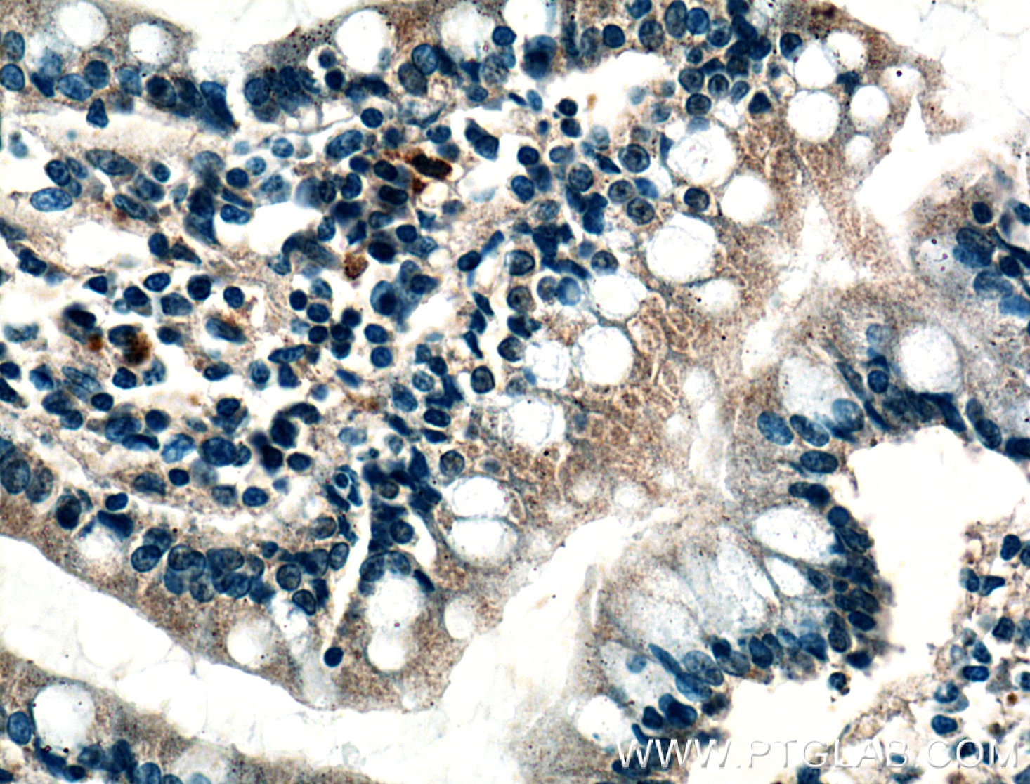 Immunohistochemistry (IHC) staining of human small intestine tissue using Calbindin-D28k Monoclonal antibody (66394-1-Ig)