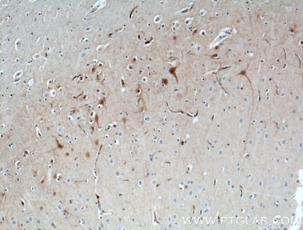 Immunohistochemistry (IHC) staining of human brain tissue using Calbindin-D28k Monoclonal antibody (66394-1-Ig)