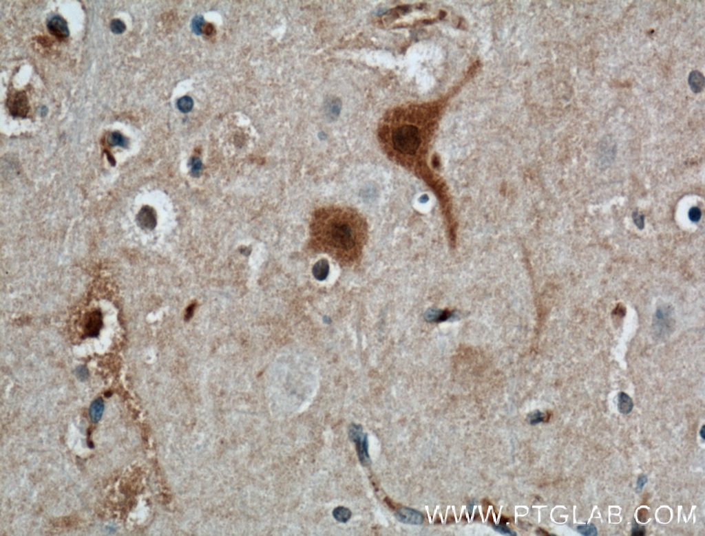 Immunohistochemistry (IHC) staining of human brain tissue using Calbindin-D28k Monoclonal antibody (66394-1-Ig)