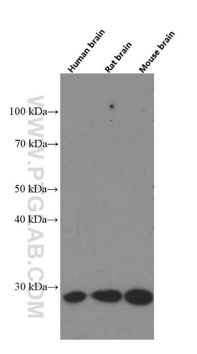 Western Blot (WB) analysis of fetal human brain tissue using Calbindin-D28k Monoclonal antibody (66394-1-Ig)