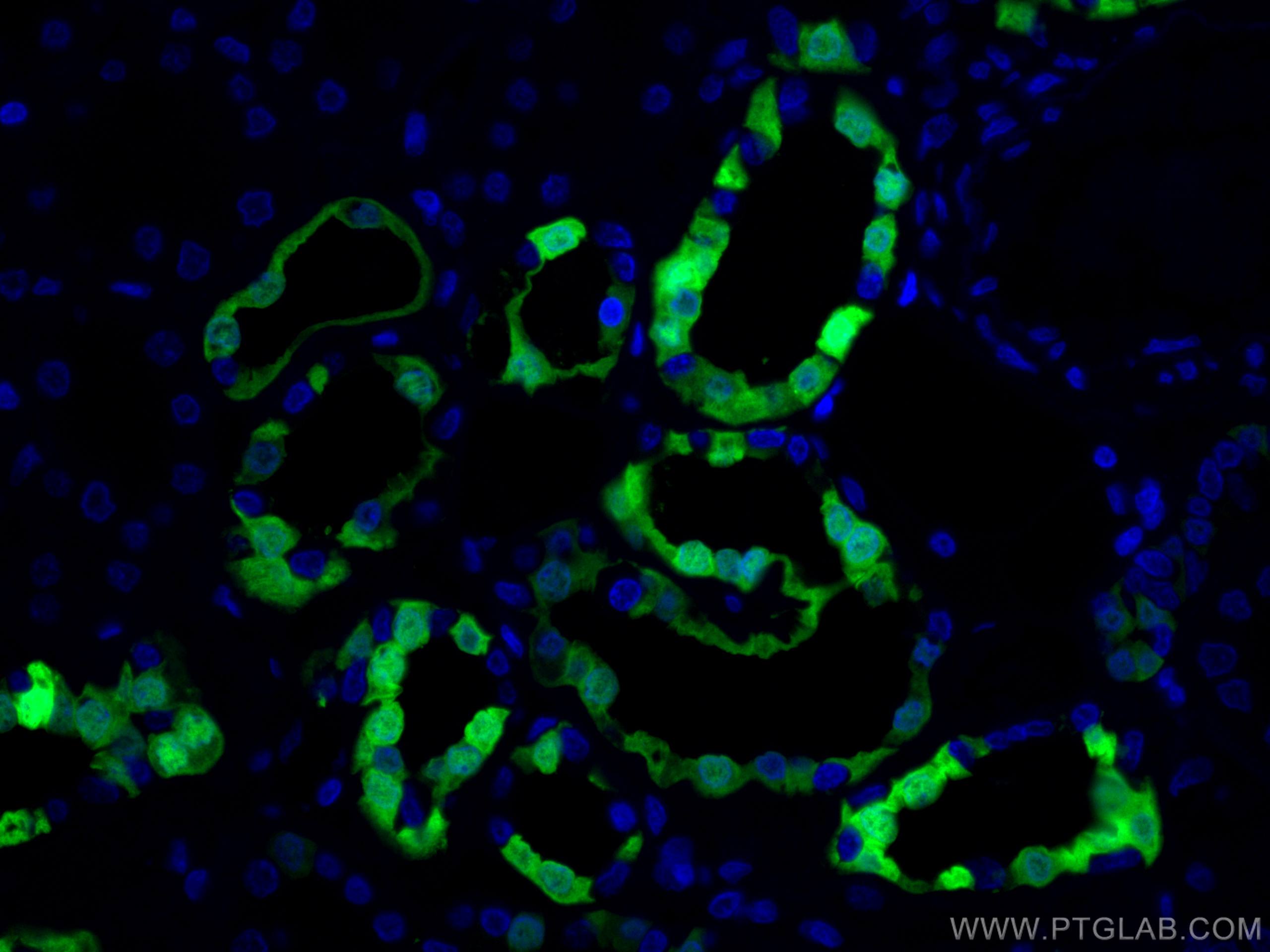 Immunofluorescence (IF) / fluorescent staining of human kidney tissue using CoraLite® Plus 488-conjugated Calbindin-D28k Polyc (CL488-14479)