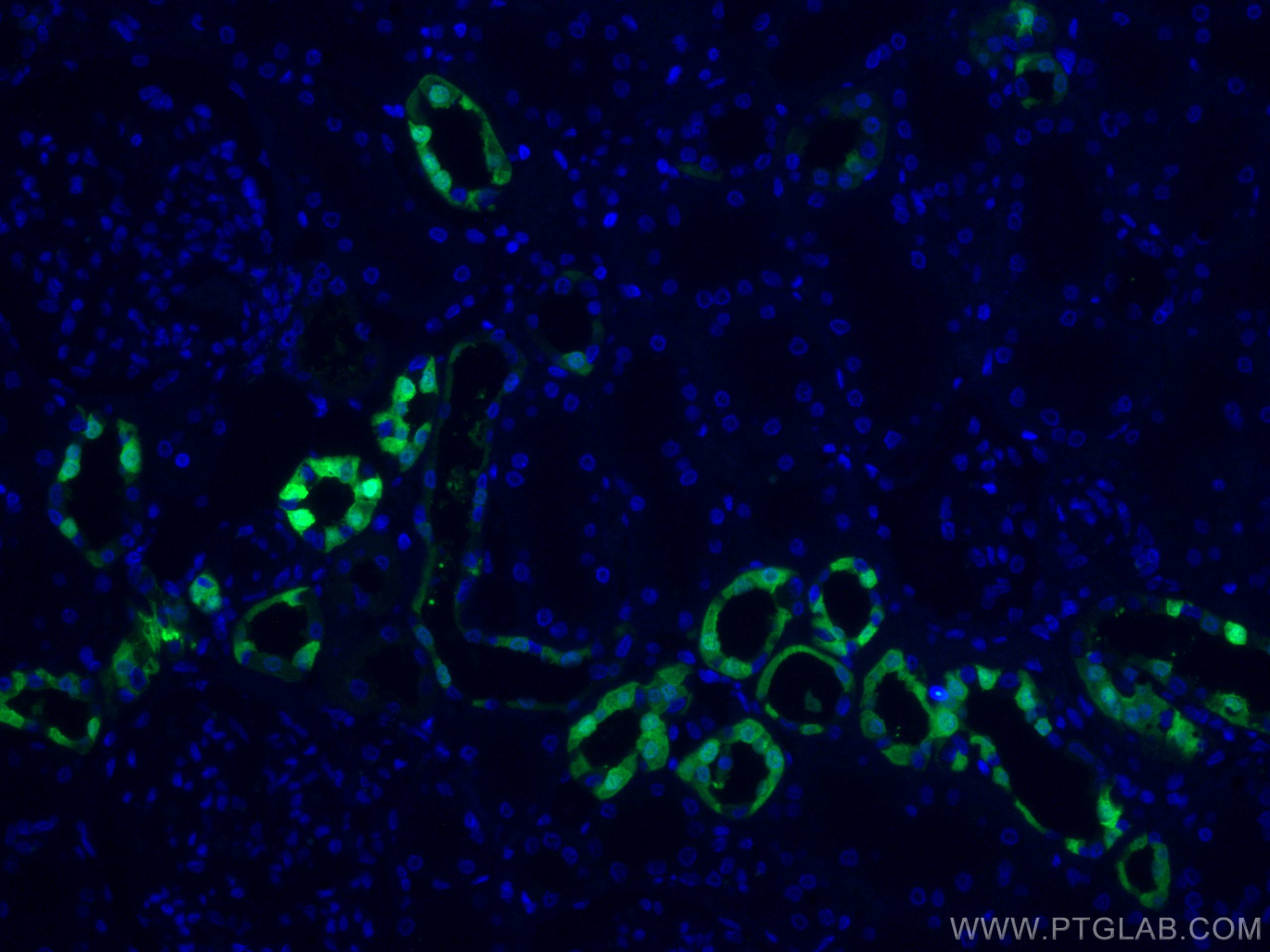 Immunofluorescence (IF) / fluorescent staining of human kidney tissue using CoraLite® Plus 488-conjugated Calbindin-D28k Polyc (CL488-14479)