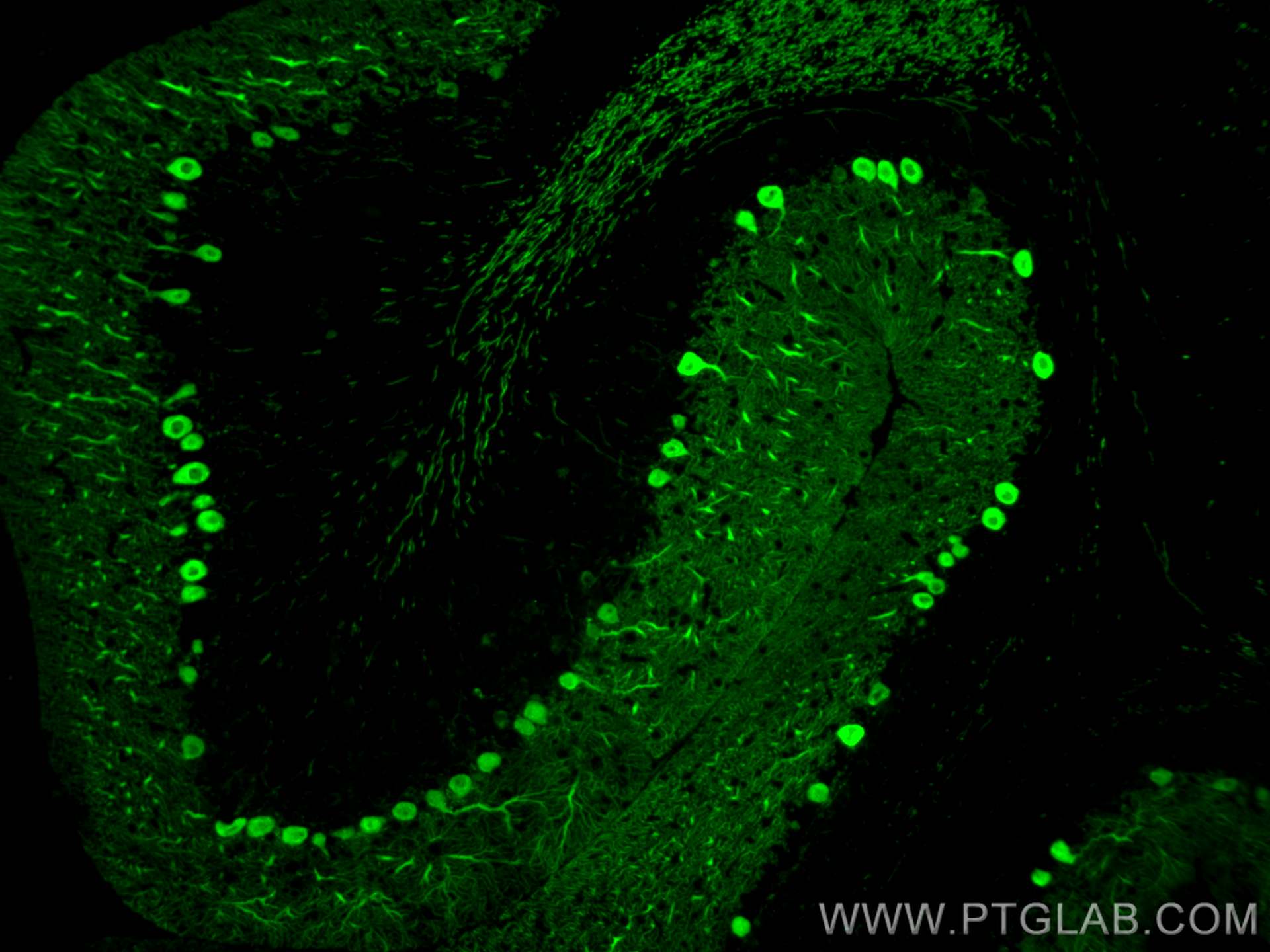 Immunofluorescence (IF) / fluorescent staining of mouse cerebellum tissue using CoraLite® Plus 488-conjugated Calbindin-D28k Polyc (CL488-14479)