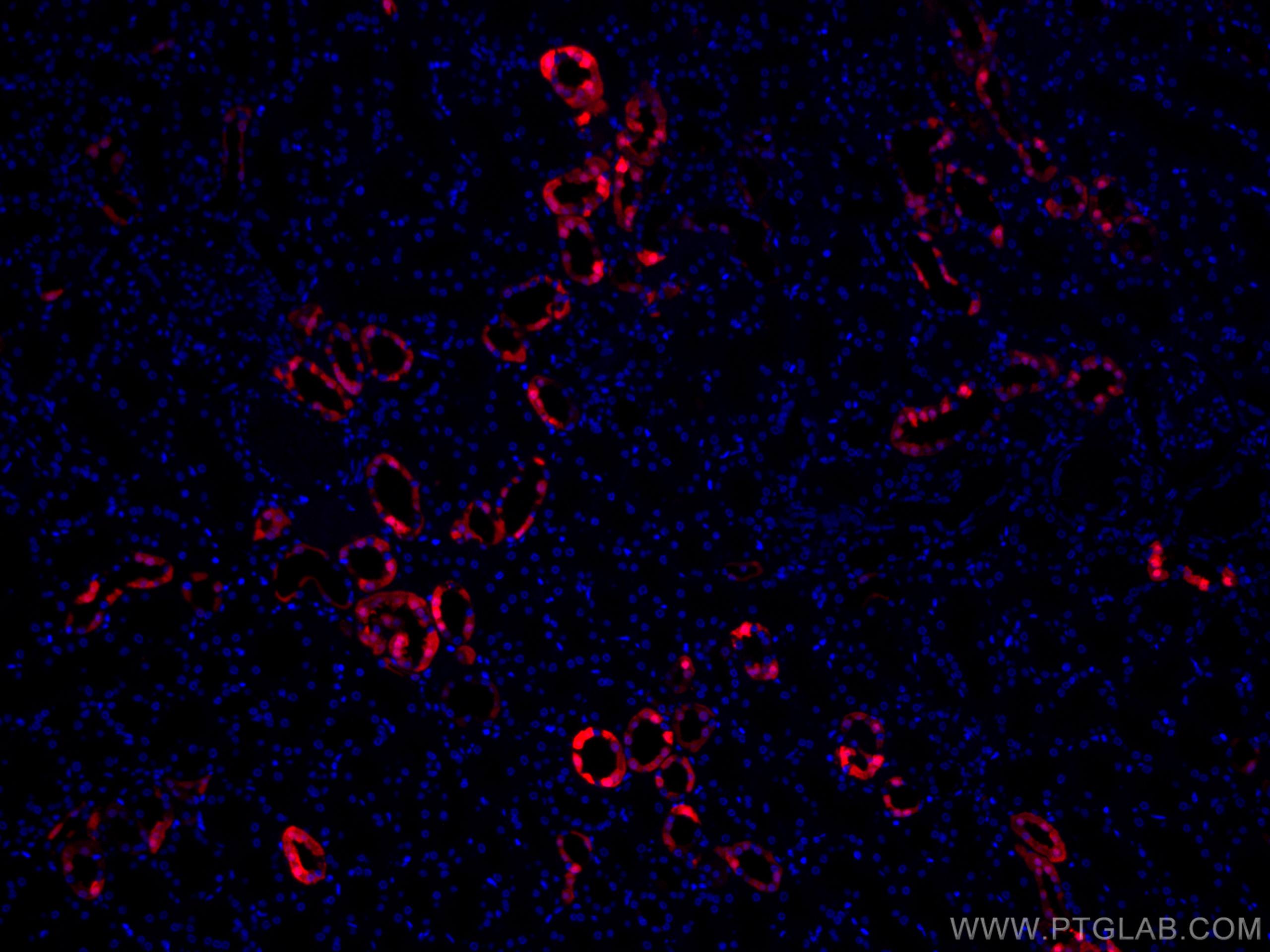 Immunofluorescence (IF) / fluorescent staining of human kidney tissue using CoraLite®594-conjugated Calbindin-D28k Polyclonal  (CL594-14479)