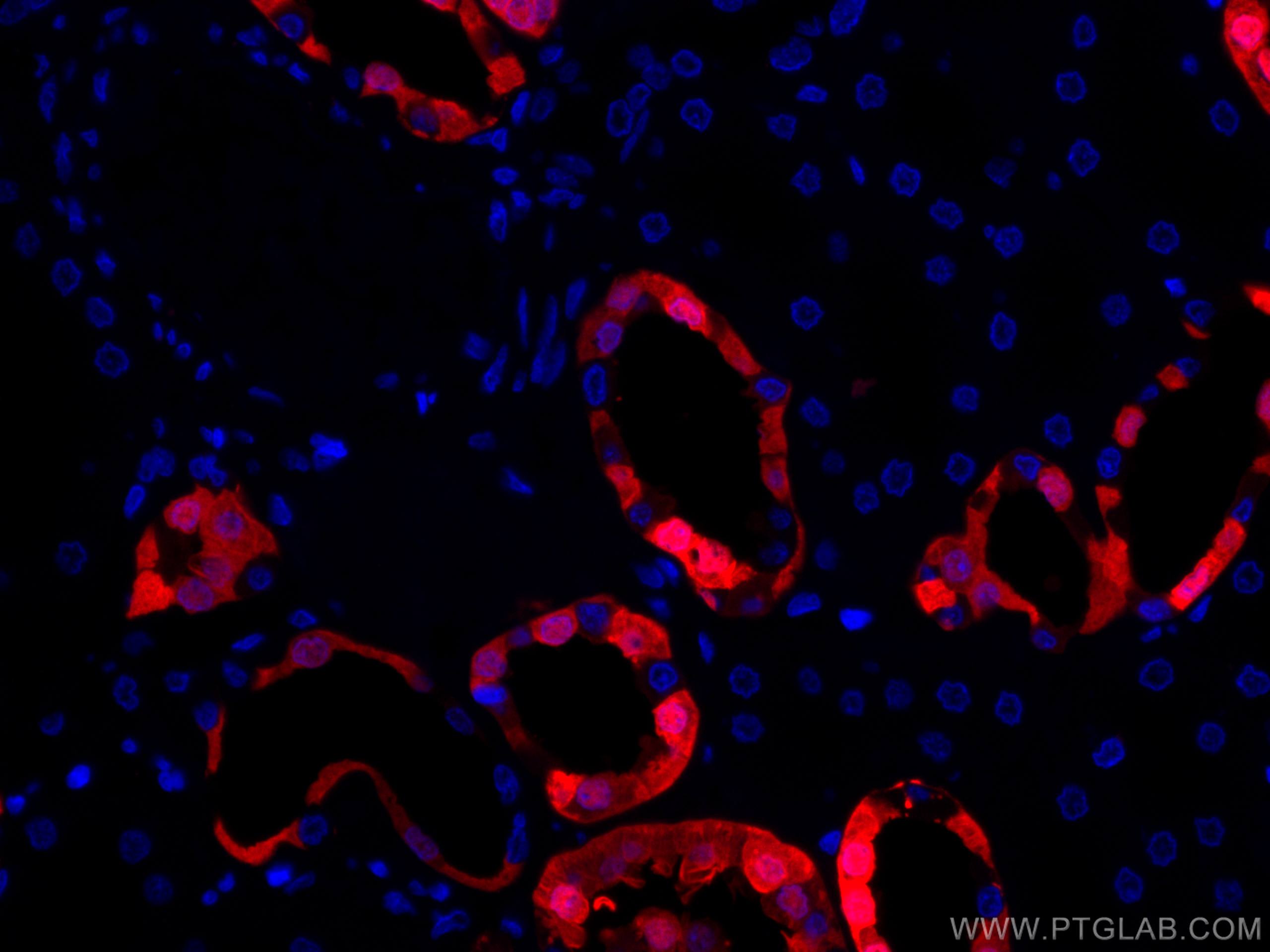 Immunofluorescence (IF) / fluorescent staining of human kidney tissue using CoraLite®594-conjugated Calbindin-D28k Polyclonal  (CL594-14479)