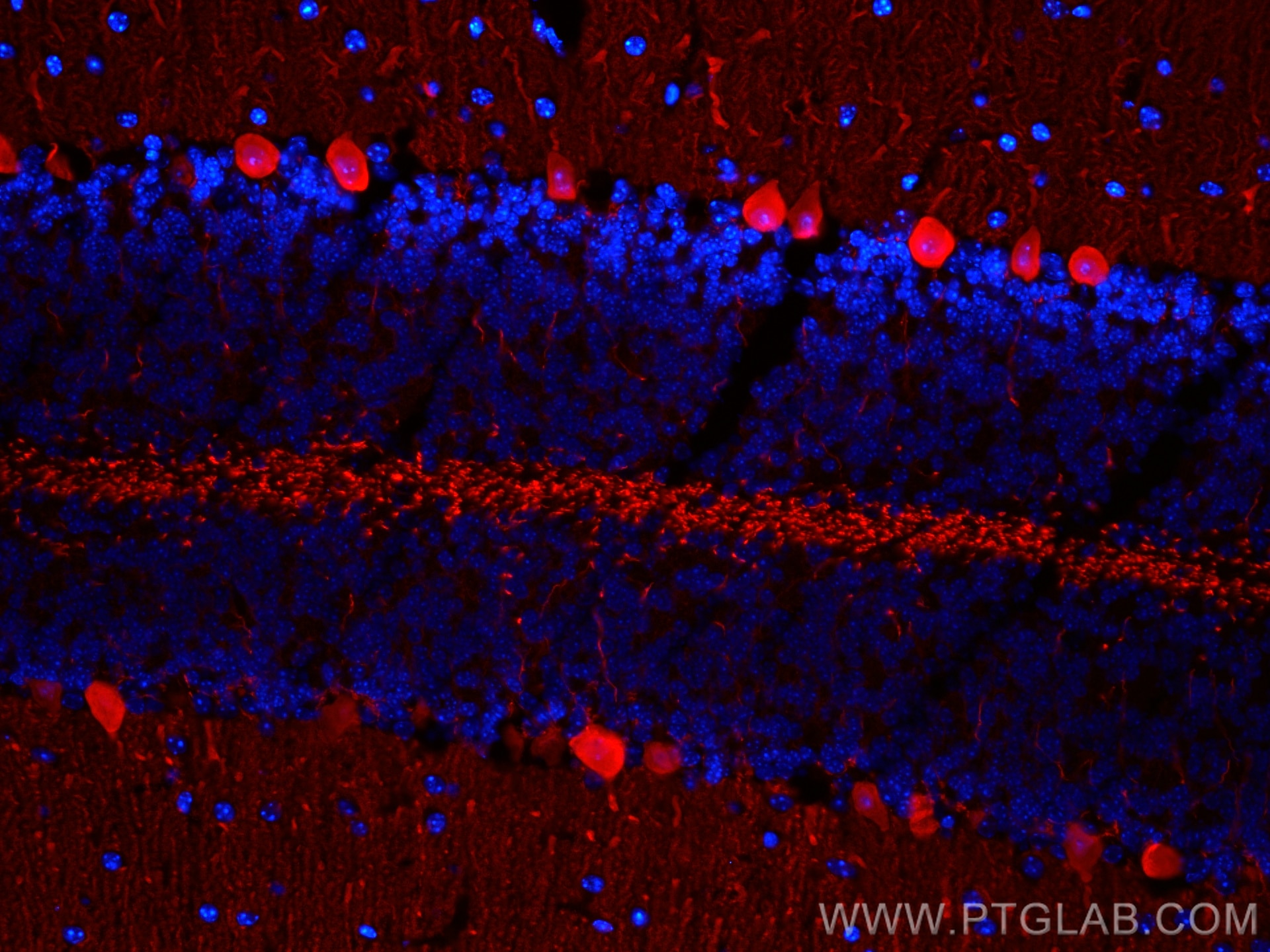 Immunofluorescence (IF) / fluorescent staining of mouse cerebellum tissue using CoraLite®594-conjugated Calbindin-D28k Polyclonal  (CL594-14479)