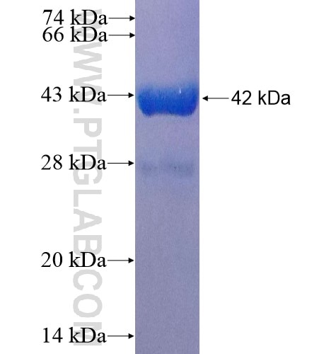 Calbindin fusion protein Ag5861 SDS-PAGE