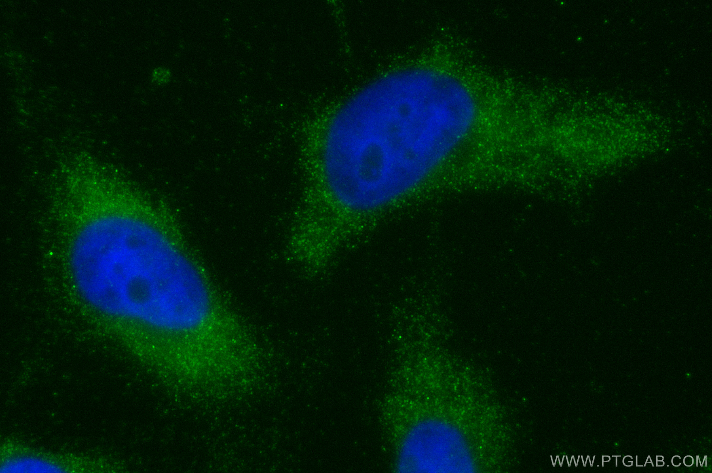 IF Staining of HeLa using 28270-1-AP