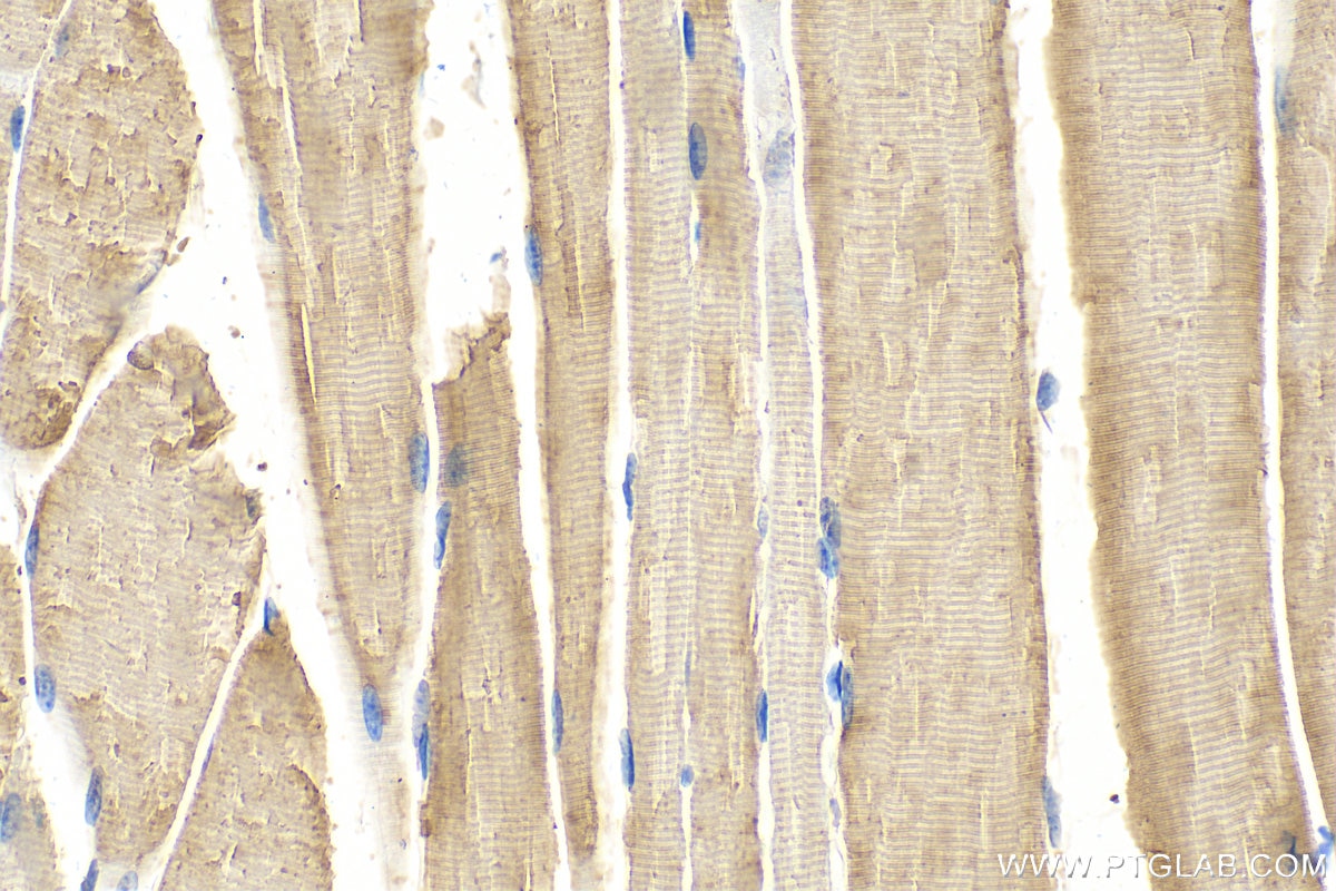 Calmodulin 1/2/3