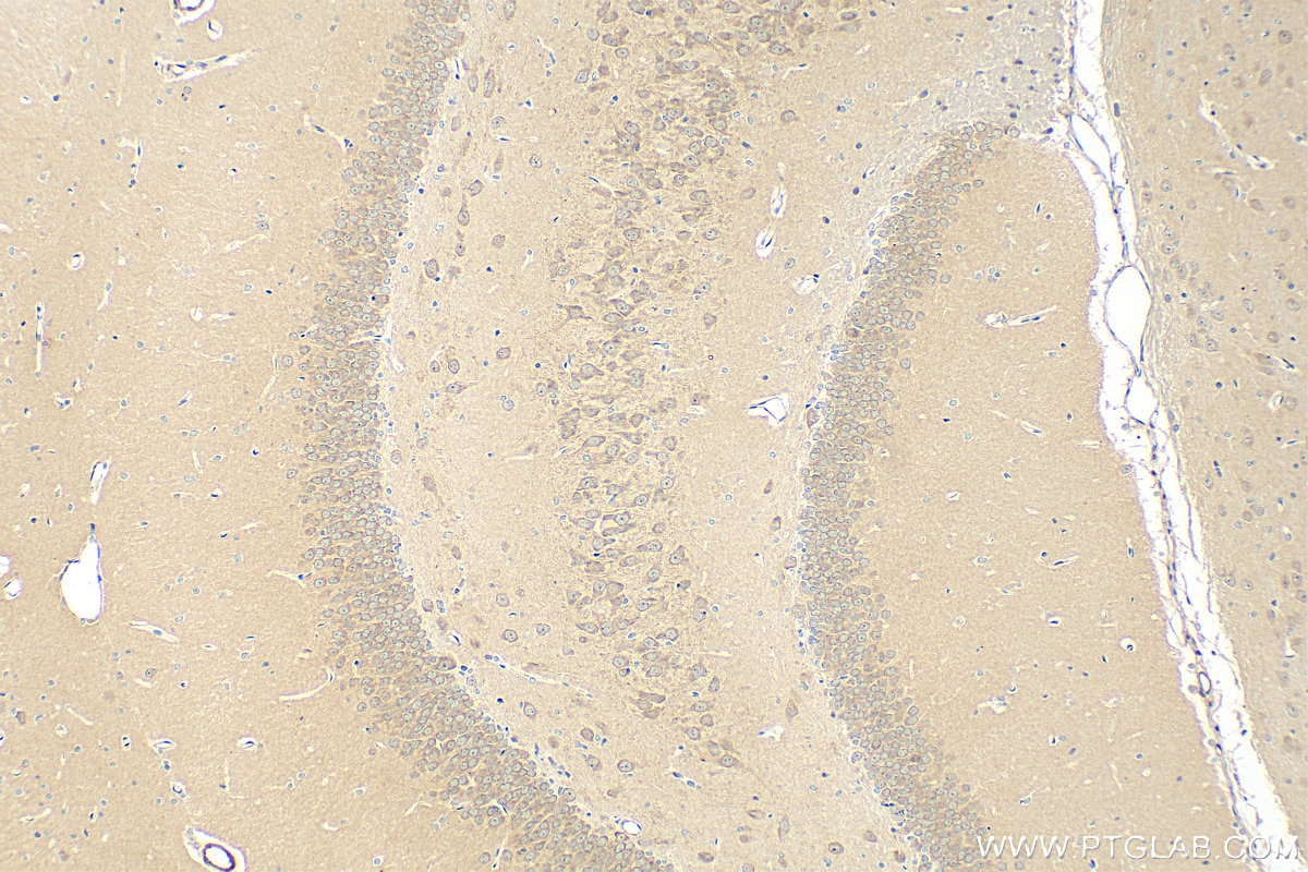 IHC staining of rat brain using 28270-1-AP