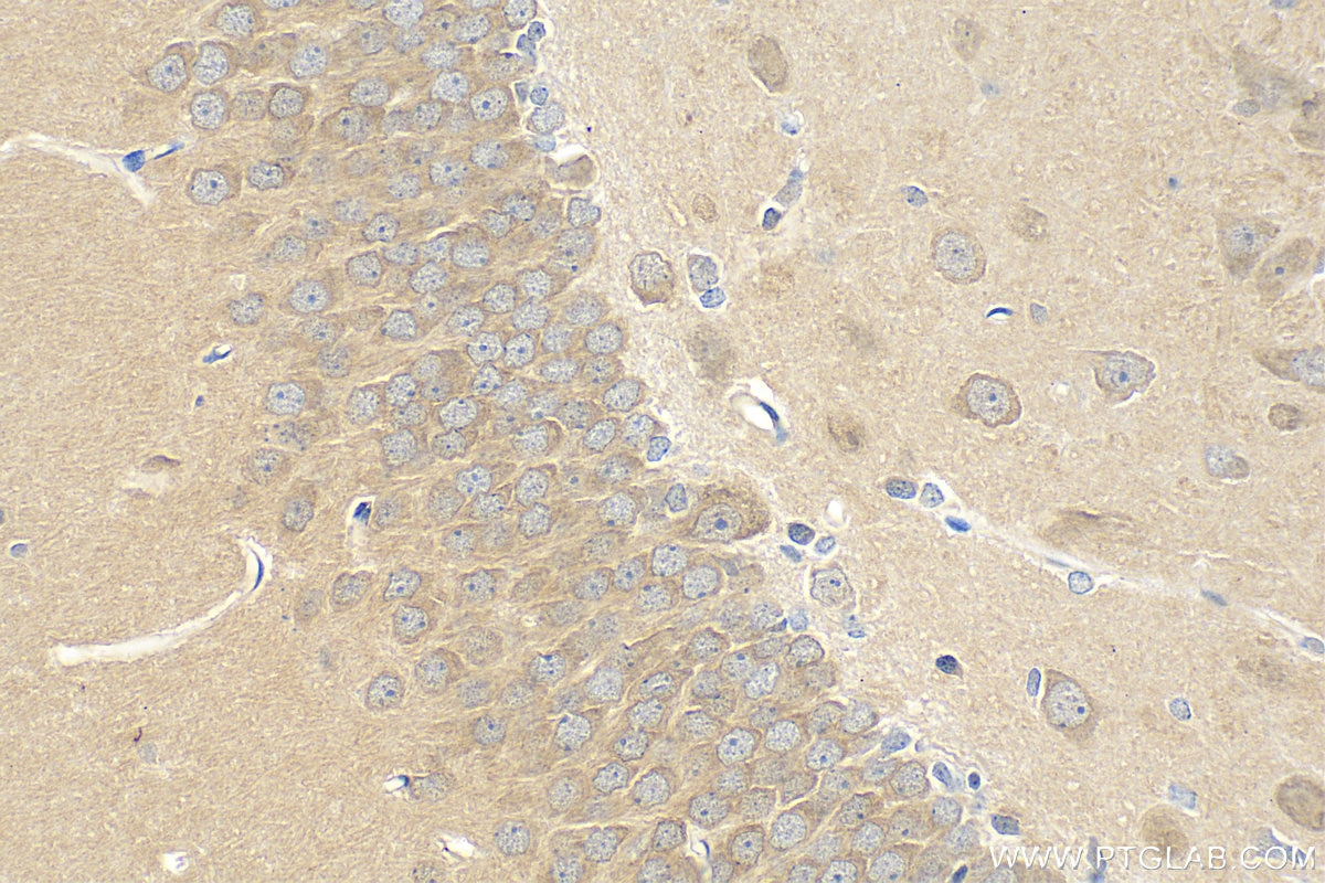 IHC staining of rat brain using 28270-1-AP