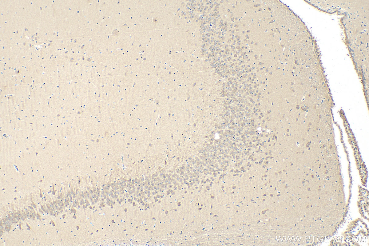 IHC staining of mouse brain using 28270-1-AP