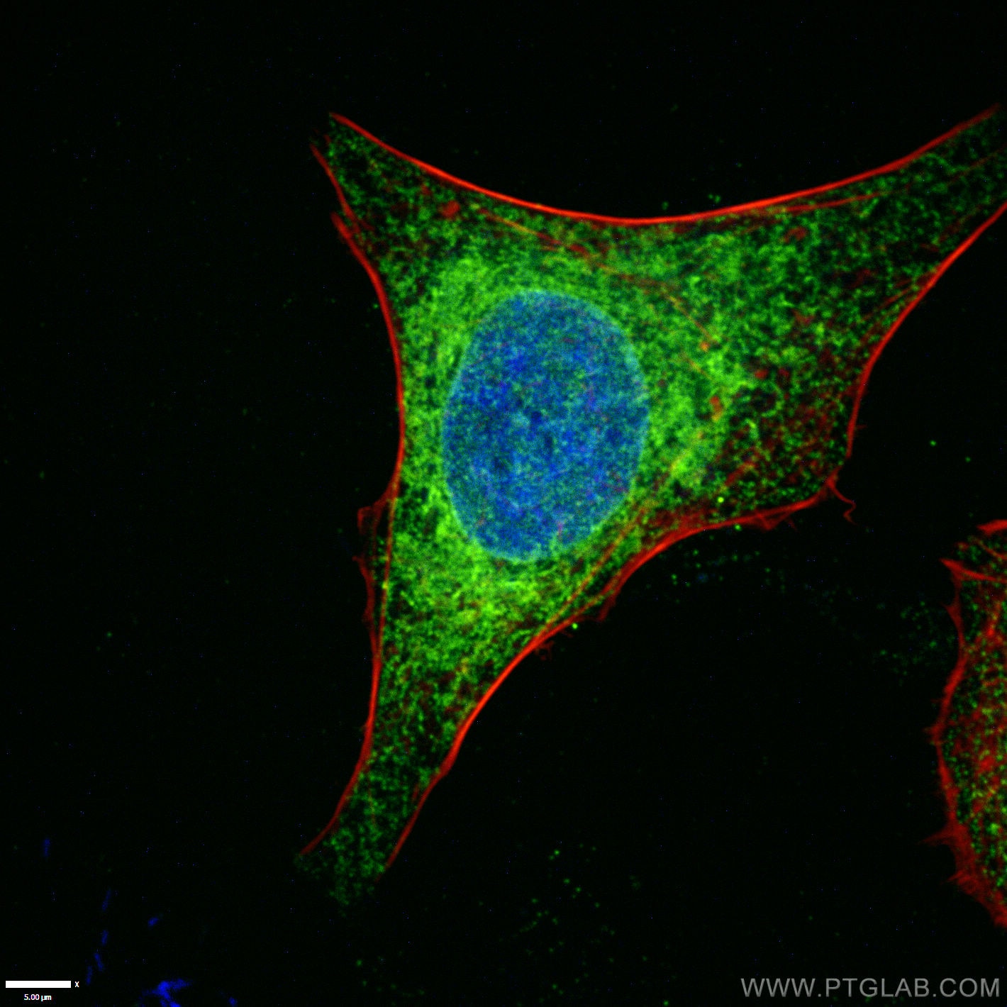 Immunofluorescence (IF) / fluorescent staining of HeLa cells using Calnexin Monoclonal antibody (66903-1-Ig)