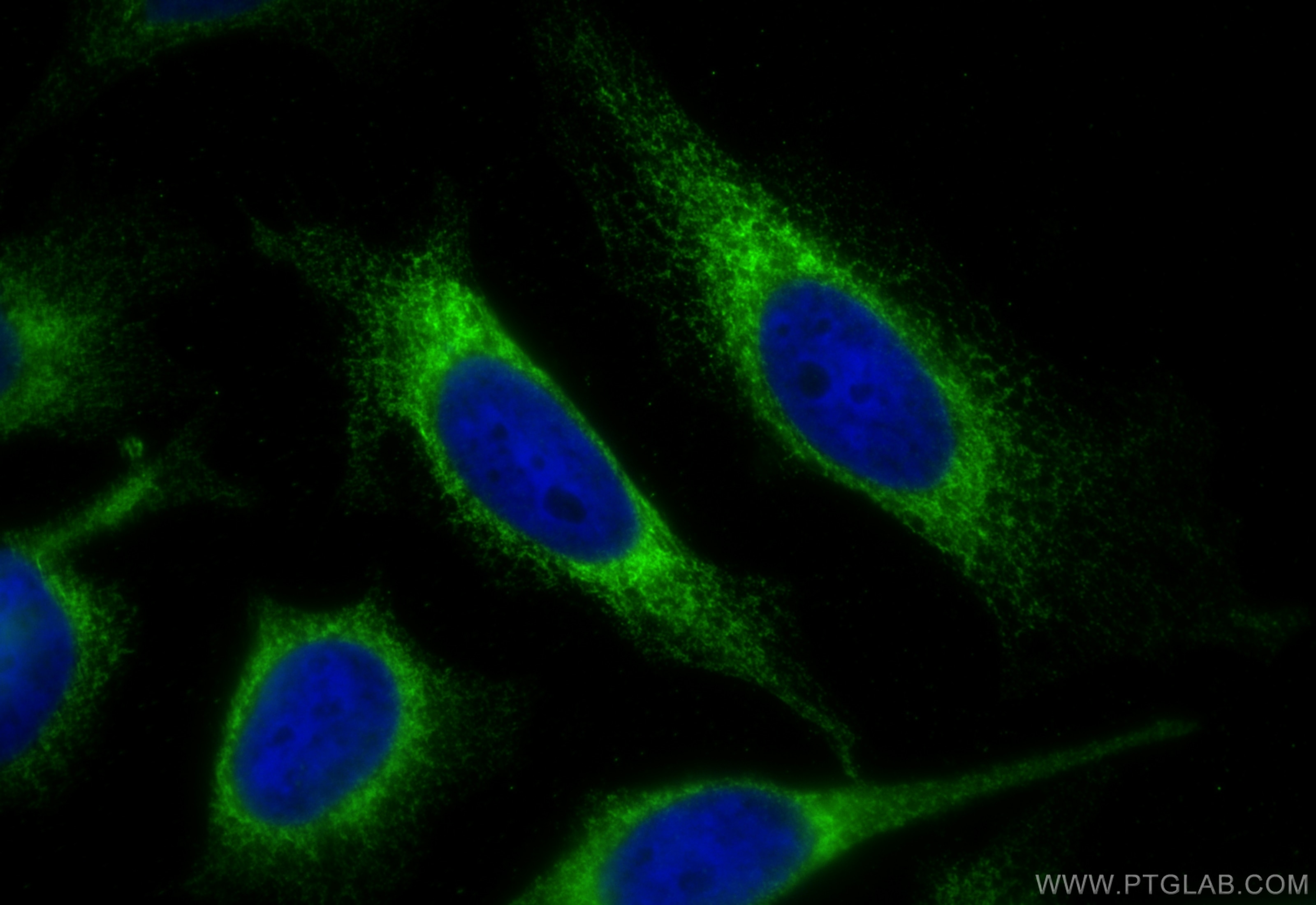 IF Staining of HeLa using 66903-1-Ig (same clone as 66903-1-PBS) Immunofluorescence (IF) / fluorescent staining of HeLa cells using Calnexin Monoclonal antibody (66903-1-Ig)