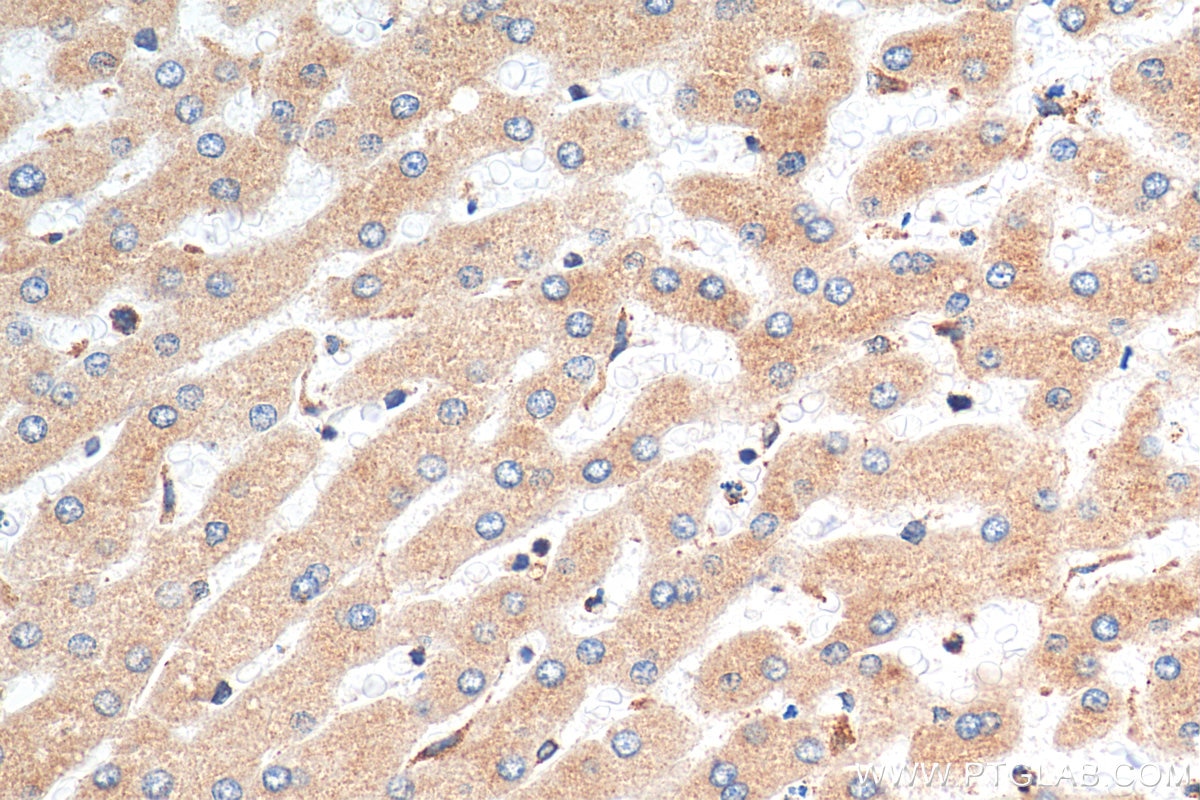Immunohistochemistry (IHC) staining of human hepatocirrhosis tissue using Calnexin Monoclonal antibody (66903-1-Ig)