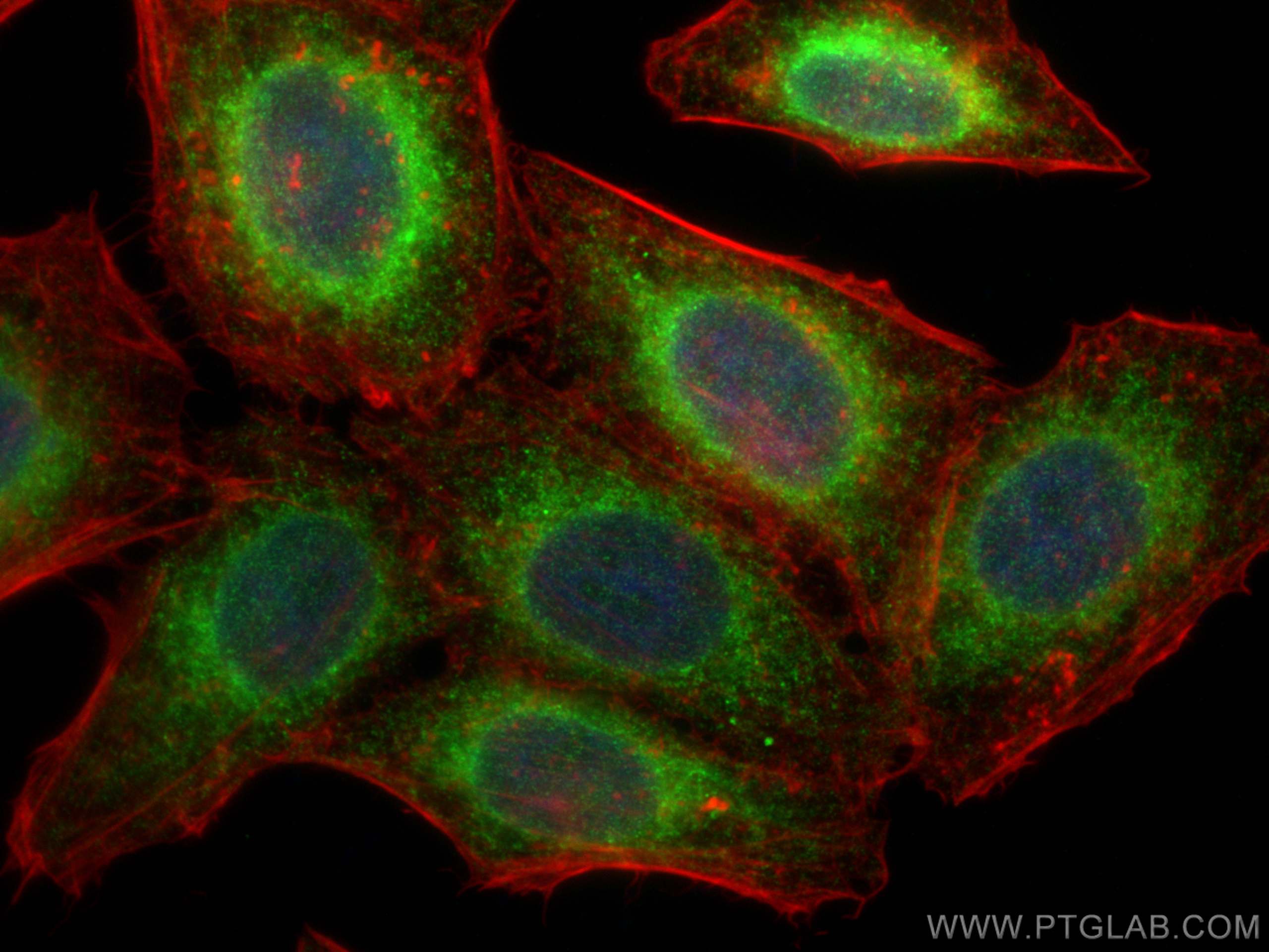 IF Staining of HepG2 using 81938-1-RR