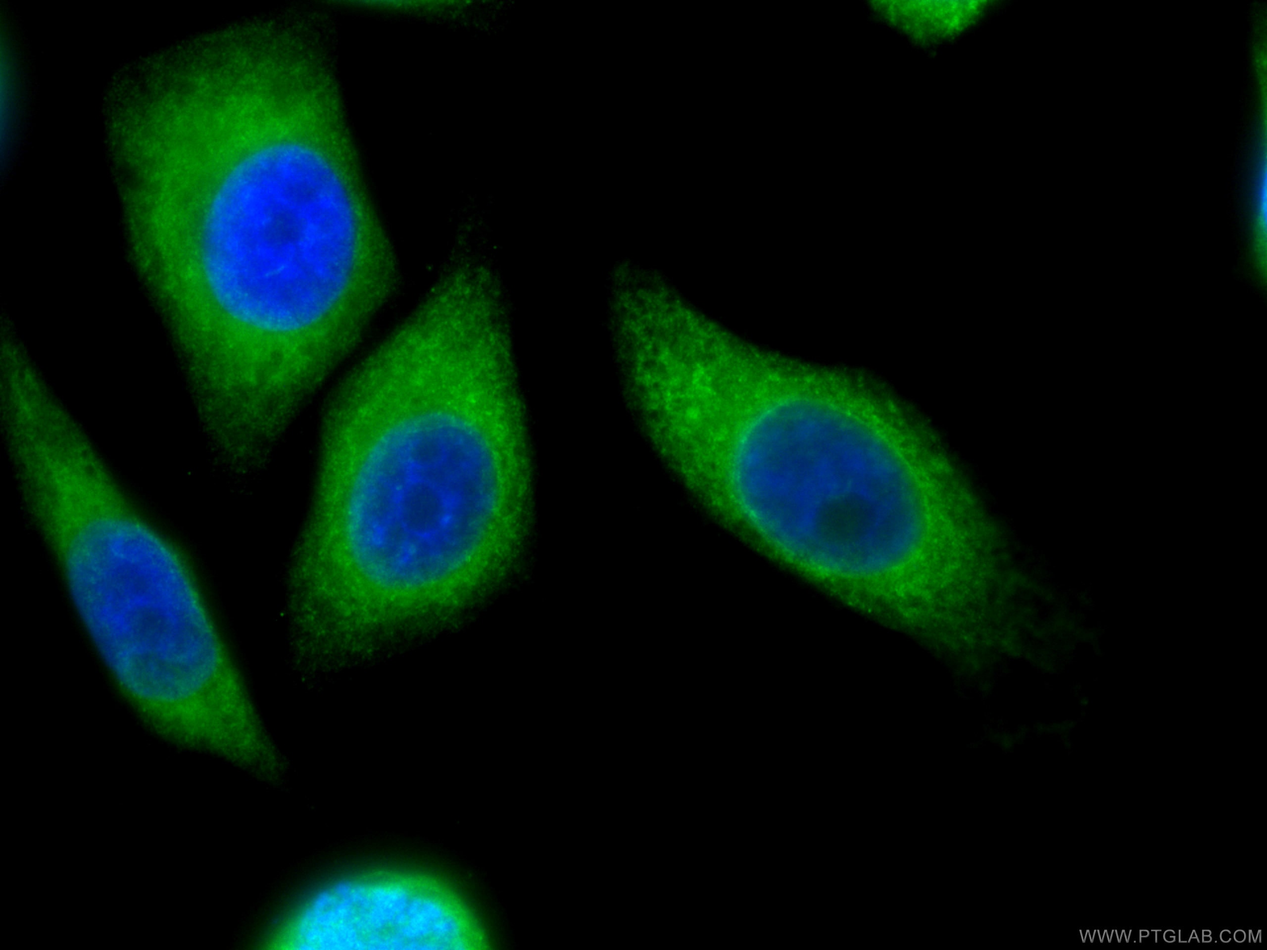 Immunofluorescence (IF) / fluorescent staining of HepG2 cells using CoraLite® Plus 488-conjugated Calnexin Monoclonal  (CL488-66903)