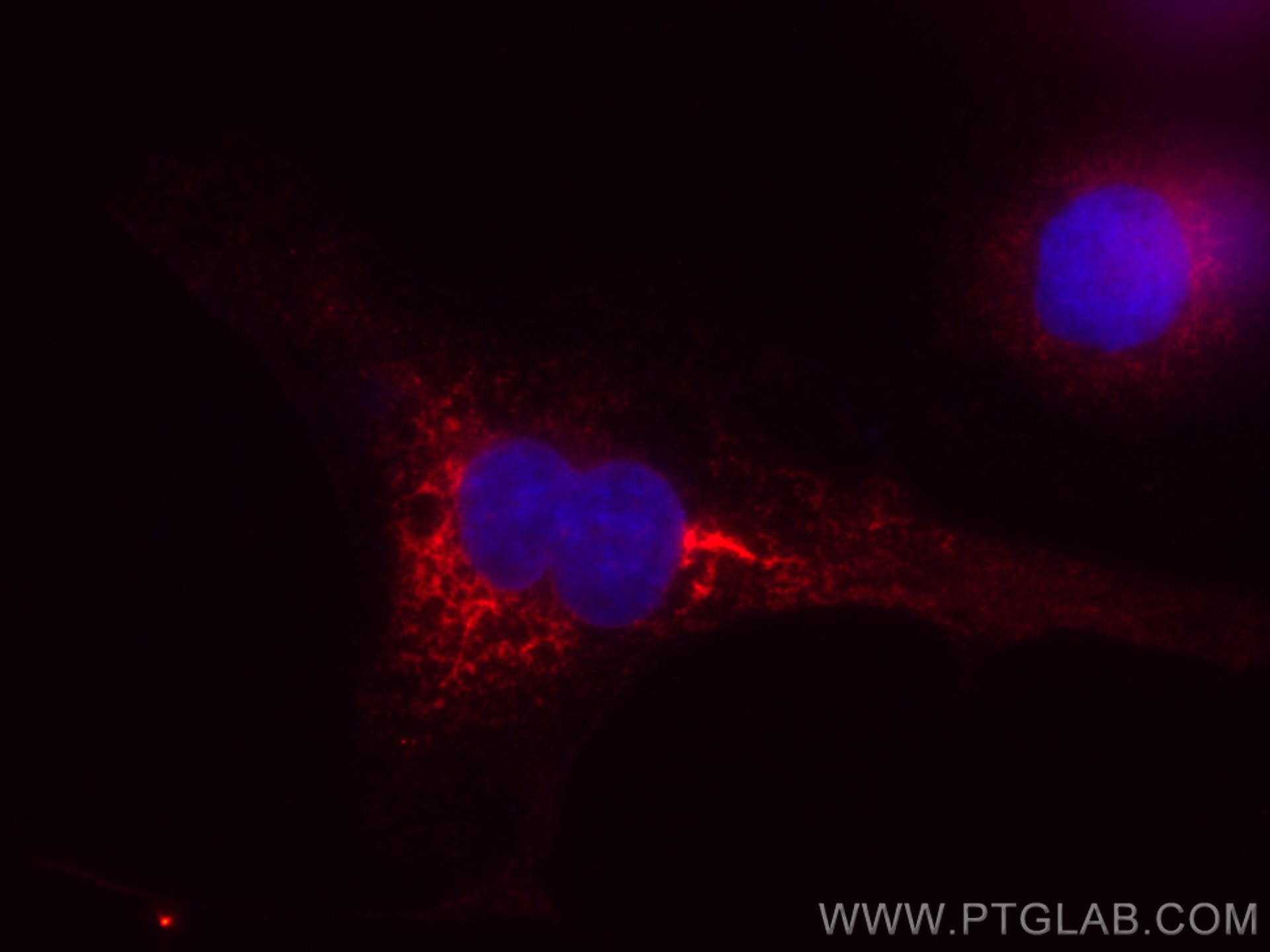 Immunofluorescence (IF) / fluorescent staining of SKOV-3 cells using CoraLite®594-conjugated Calnexin Monoclonal antibo (CL594-66903)