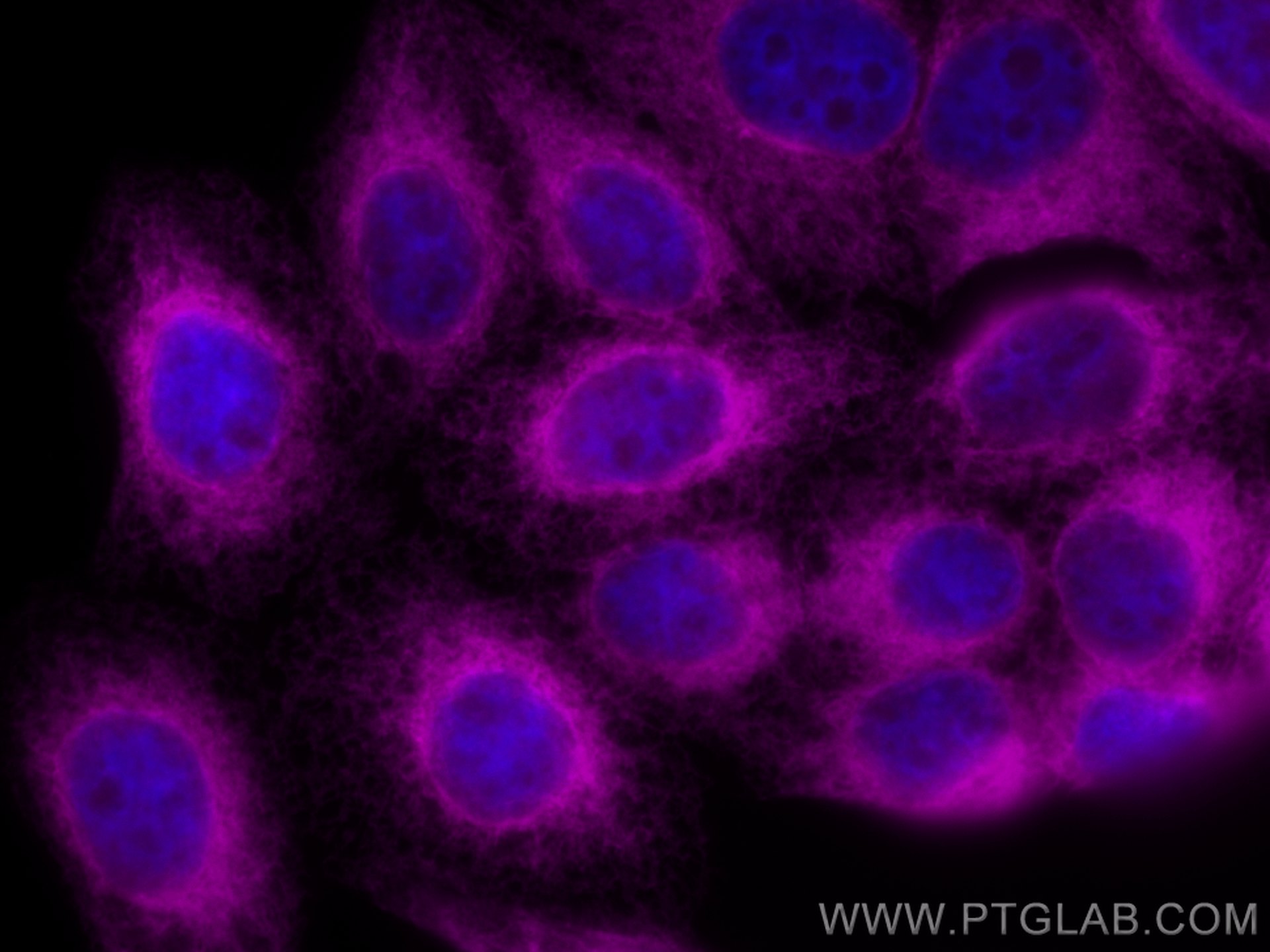 Immunofluorescence (IF) / fluorescent staining of HepG2 cells using CoraLite® Plus 647-conjugated Calnexin Polyclonal  (CL647-10427)