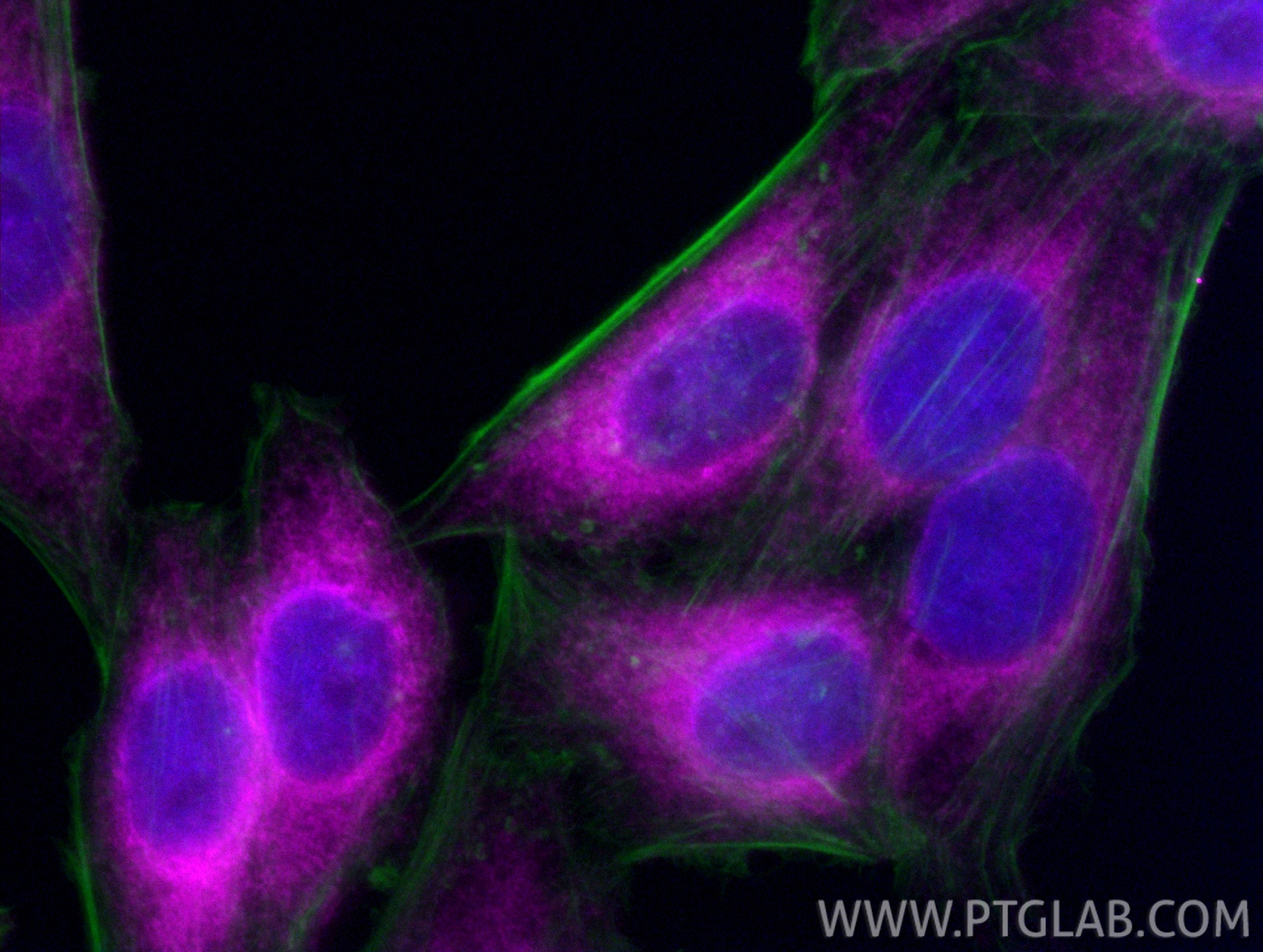 Immunofluorescence (IF) / fluorescent staining of HepG2 cells using CoraLite® Plus 647-conjugated Calnexin Recombinant (CL647-81938)